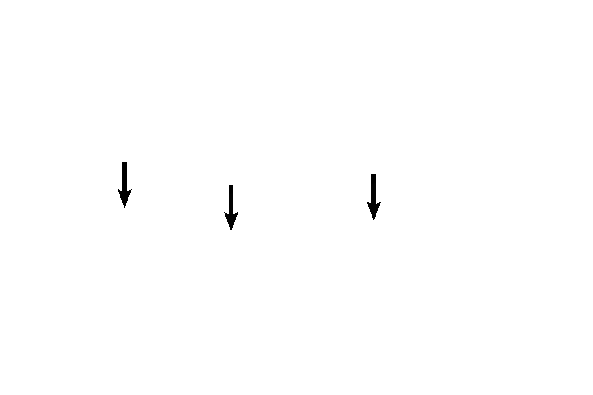 Mixed glands <p>The trachealis muscle is smooth muscle that spans the opening between the ends of each cartilage ring, controlling the diameter of the trachea. Frequently, mixed glands accumulate over this muscle. 40x </p>
