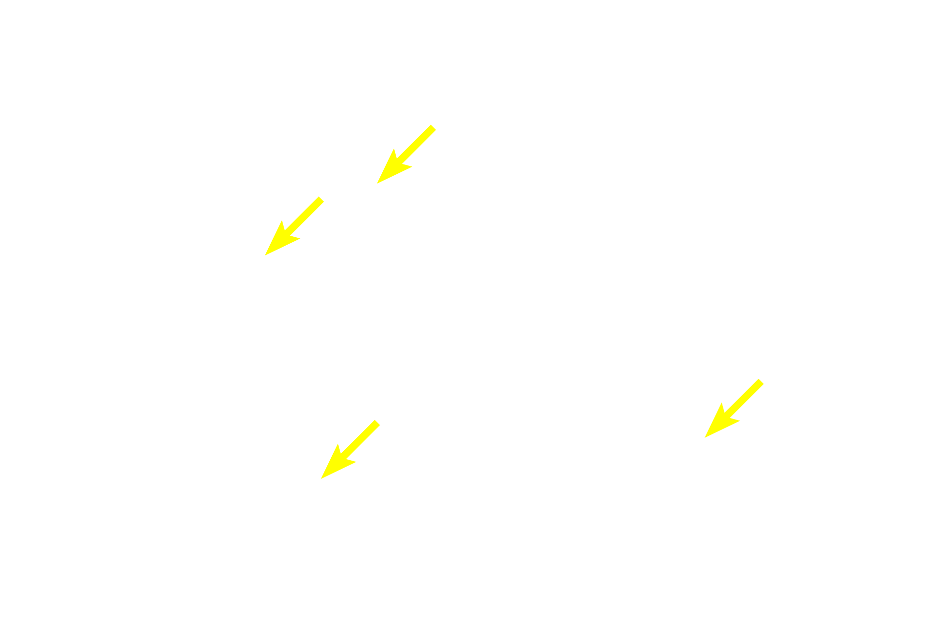 Ducts <p>Another simple gland is the simple, coiled tubular gland.  These glands consist of a very long, unbranched duct that is continuous with the coiled secretory portion.  An example of this gland is this eccrine sweat gland in skin.  The connection between these ducts and their glandular portions is out of the plane of section.  Skin 100x</p>
