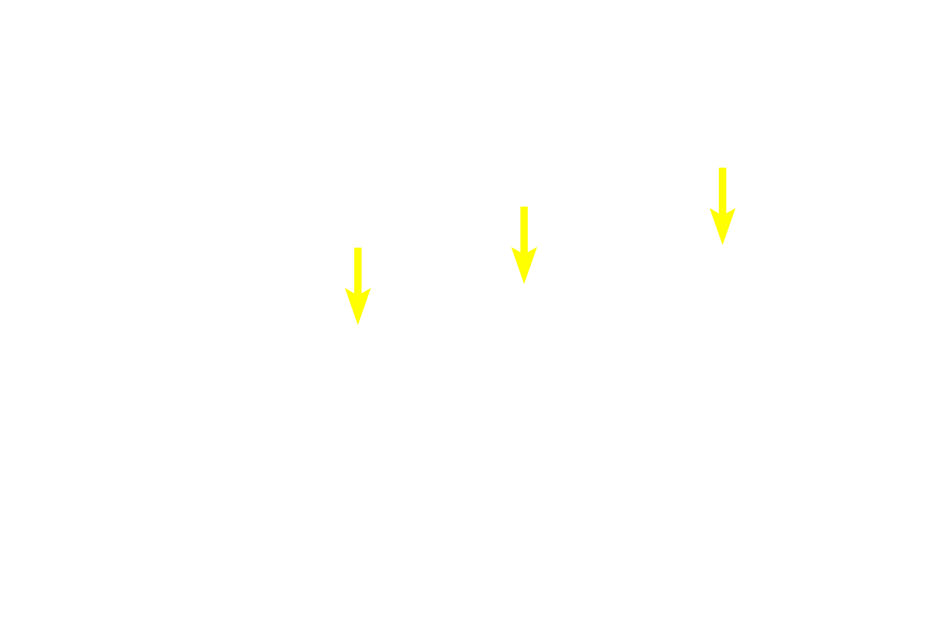  - Basal cell nuclei <p>Although pseudostratified epithelium appears stratified, all of its cells rest on the basement membrane.  The epithelium pictured here is ciliated and possesses unicellular glands that secrete mucus, called goblet cells. Both the cilia and unicellular glands indicate that this is a simple epithelium.  Trachea  1000x</p>
