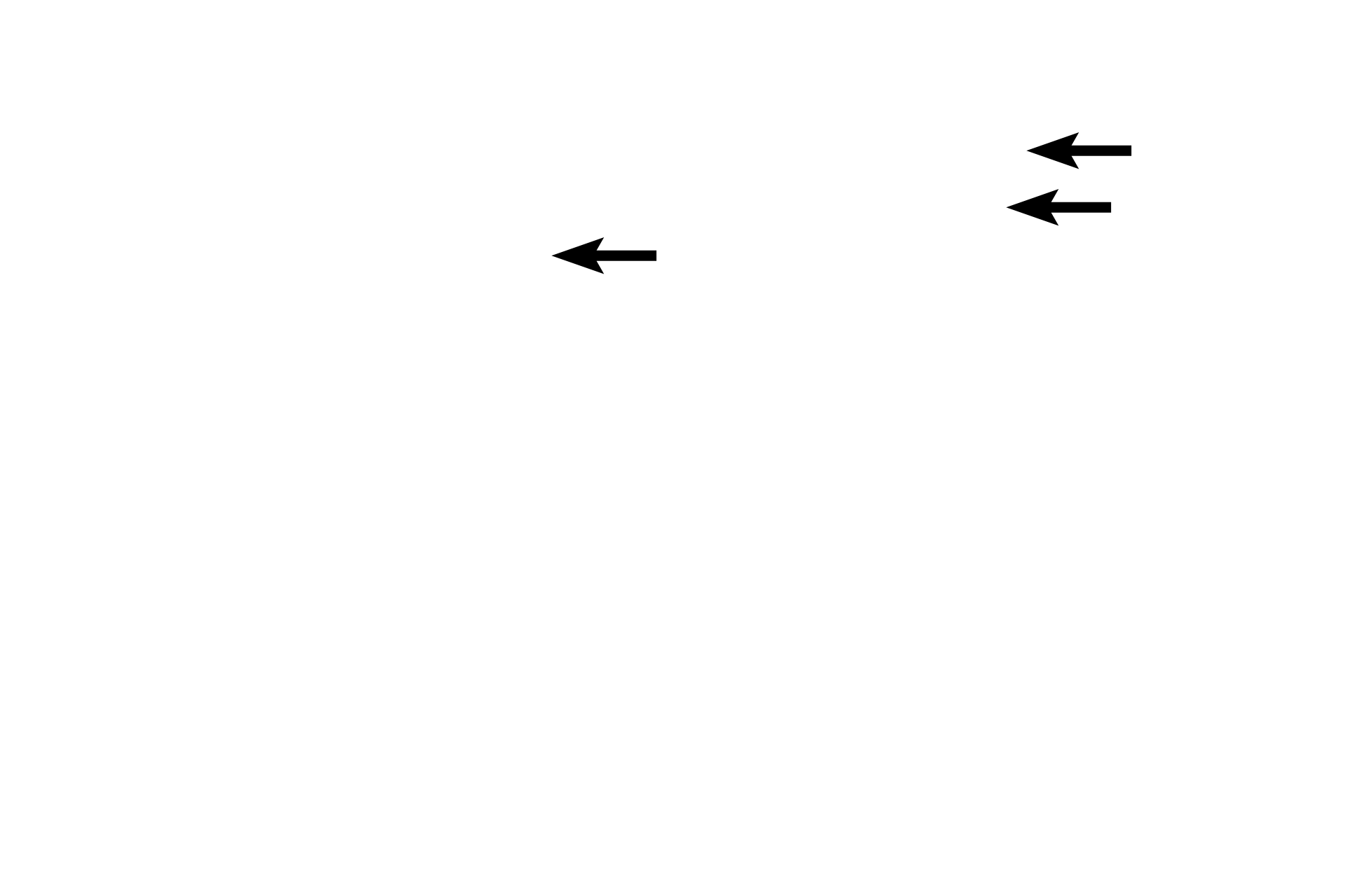 Sulcular epithelium > <p>The masticatory mucosa extends to the free gingival margin where it becomes continuous with that of the sulcular  epithelium.  The sulcular epithelium faces the sulcular groove and is composed of a stratified squamous moist epithelium.</p>
