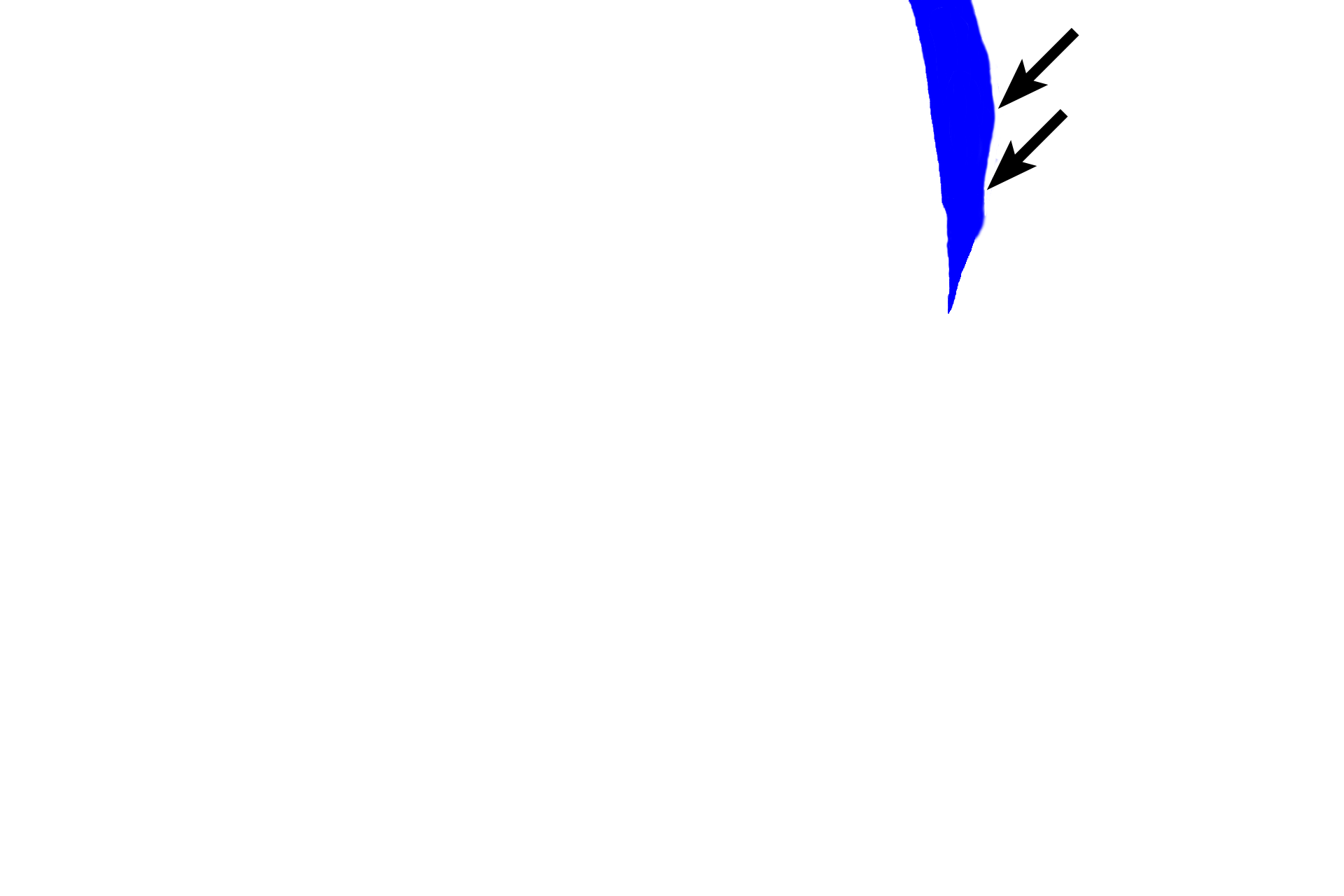Gingival sulcus > <p>The gingival sulcus is a circular moat around the tooth and is located between the sulcular epithelium and the enamel of the tooth.  The approximate location of the enamel is illustrated in blue.  Because of its calcium content, the enamel is lost during the preparation of this decalcified tooth preparation. </p>
