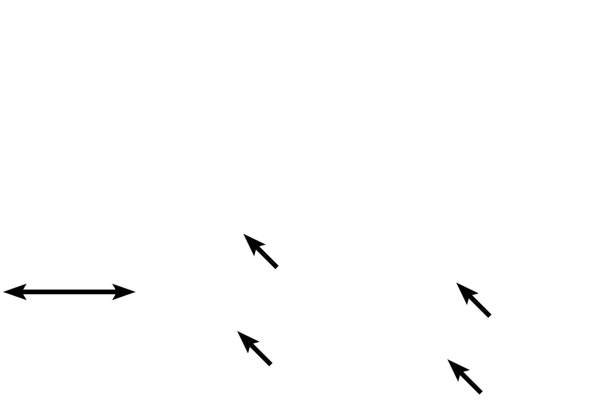 Alveolar bone <p>The periodontal ligament is the fibrous connective tissue that attaches the cementum of the tooth to the surrounding alveolar bone.  The periodontal ligament is richly vascularized along nerve endings for pain and pressure.  </p>
