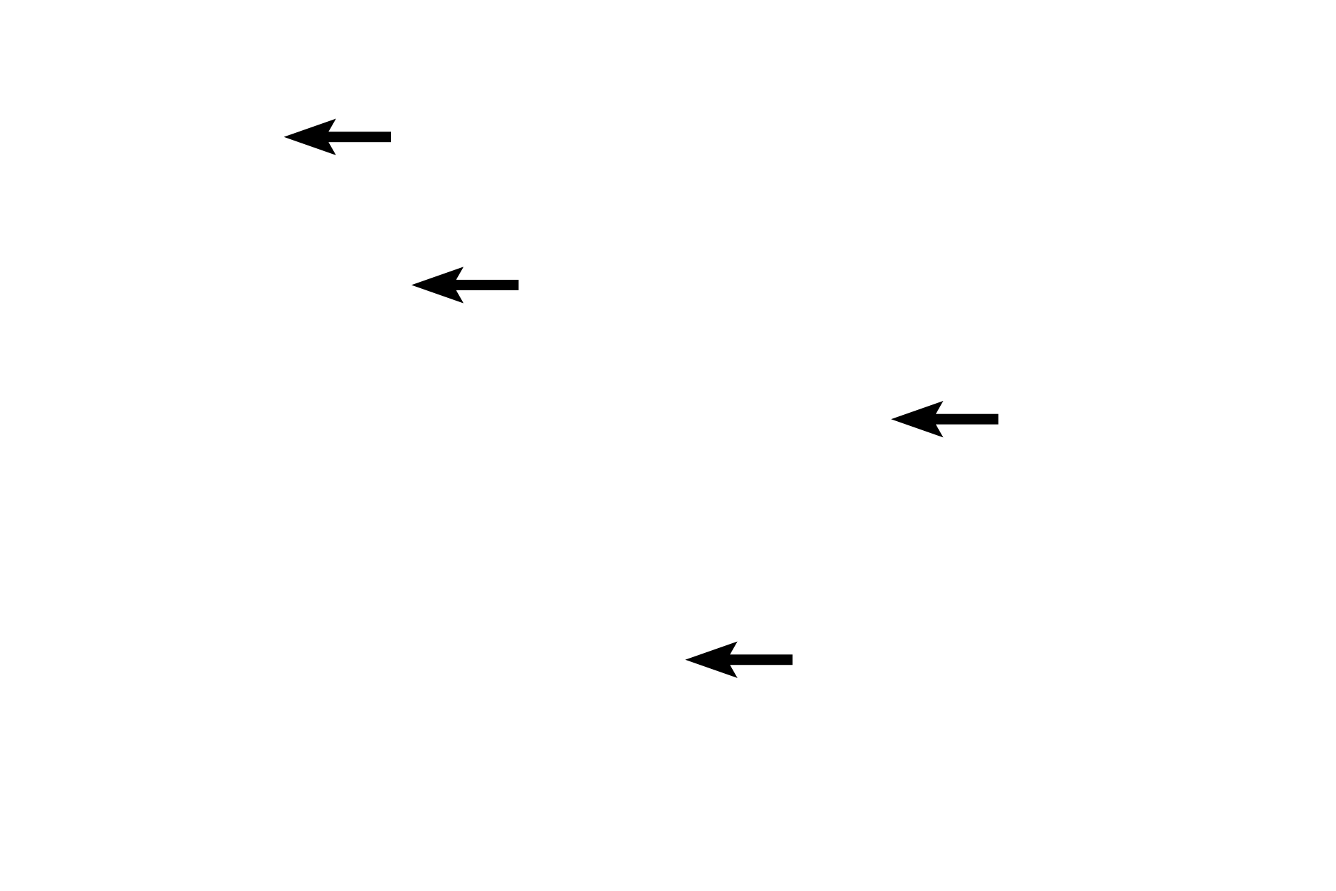 Venules <p>Diffuse lymphoid tissue, as well as solitary and aggregated lymphoid nodules in the lamina propria, filter tissue fluid that eventually passes into lymphatic capillaries as lymph. Lymph capillaries are the blind-ended beginnings of a complex network of vessels that eventually drain through lymph nodes and into the blood vascular system. Lymph contains high levels of protein and thus the lumen of lymphatic vessels often stains pink with eosin. Esophagus 200x</p>
