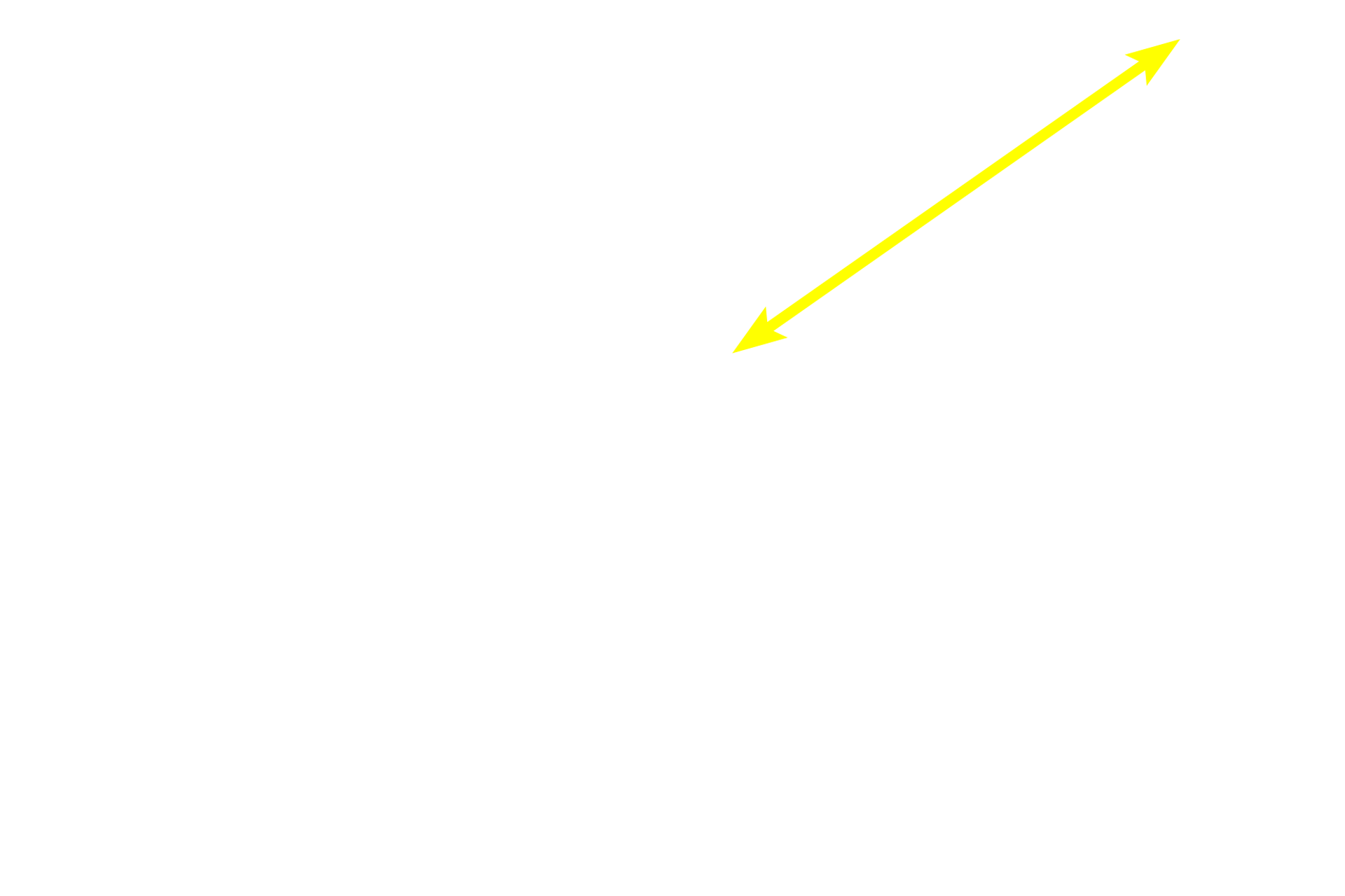 Epithelium <p>Diffuse lymphoid tissue, as well as solitary and aggregated lymphoid nodules in the lamina propria, filter tissue fluid that eventually passes into lymphatic capillaries as lymph. Lymph capillaries are the blind-ended beginnings of a complex network of vessels that eventually drain through lymph nodes and into the blood vascular system. Lymph contains high levels of protein and thus the lumen of lymphatic vessels often stains pink with eosin. Esophagus 200x</p>
