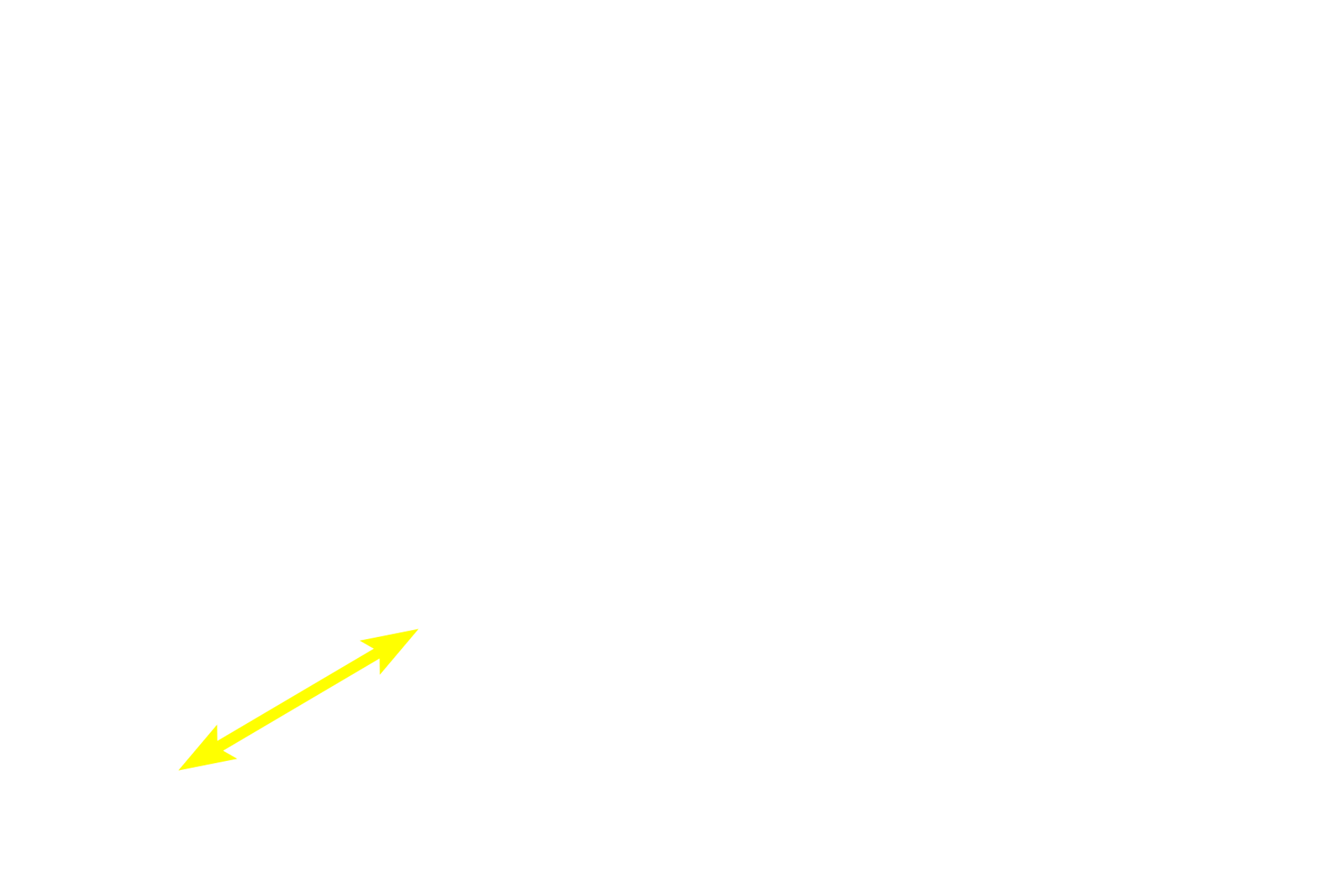 Muscularis mucosae <p>Diffuse lymphoid tissue, as well as solitary and aggregated lymphoid nodules in the lamina propria, filter tissue fluid that eventually passes into lymphatic capillaries as lymph. Lymph capillaries are the blind-ended beginnings of a complex network of vessels that eventually drain through lymph nodes and into the blood vascular system. Lymph contains high levels of protein and thus the lumen of lymphatic vessels often stains pink with eosin. Esophagus 200x</p>

