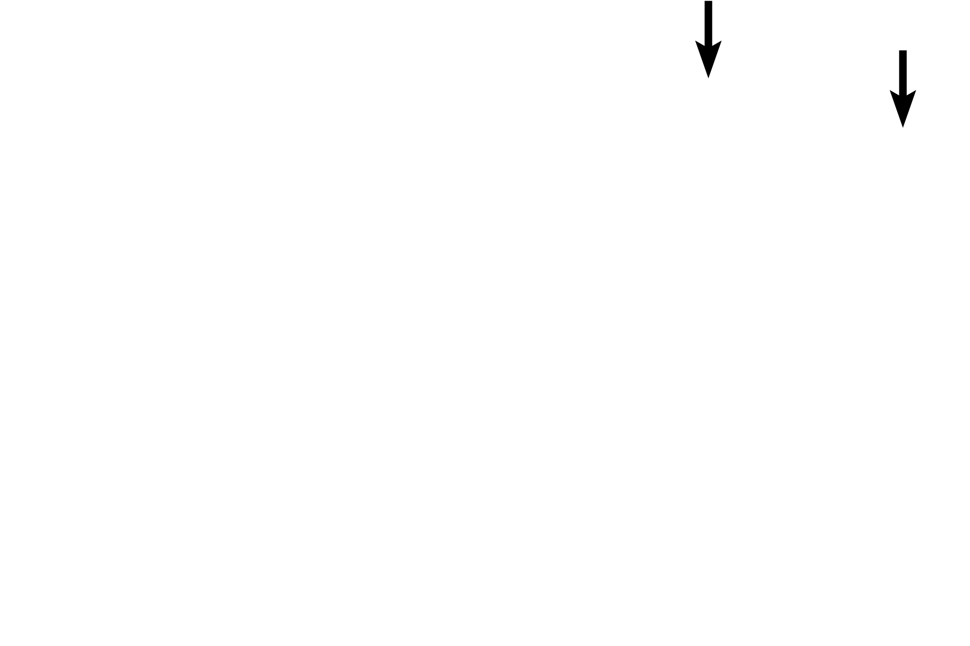 Epithelium <p>Secondary nodules consist of an outer mantle (corona) of B lymphocytes surrounding the germinal center, where the immunoresponsive B lymphocytes are formed.  The germinal center forms following antigen stimulation.  The germinal center contains phagocytic cells and large, immature lymphoblasts that divide to form the smaller B lymphocytes.  These B cells migrate to and accumulate at the periphery in the mantle or corona region.</p>
