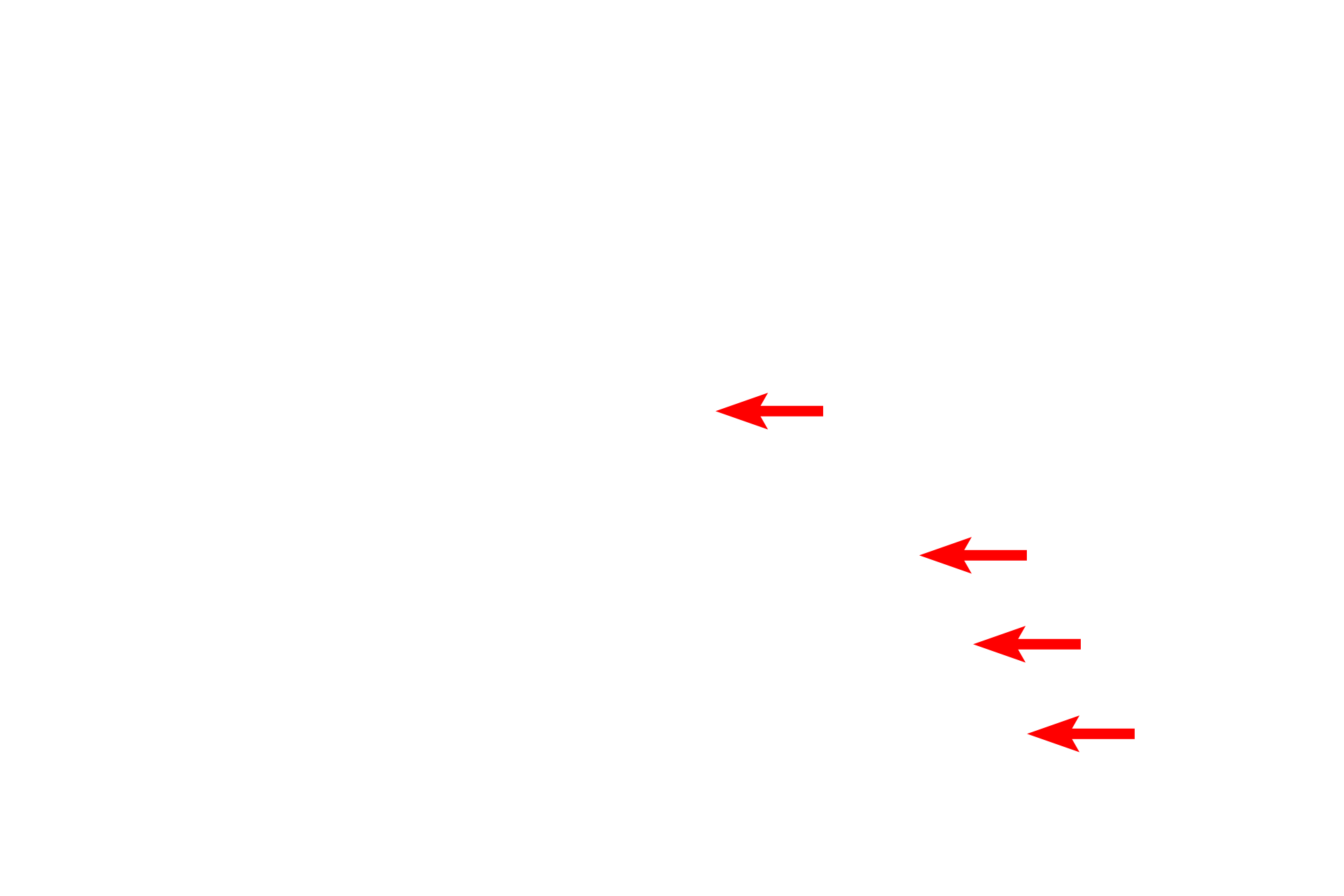 Stratum corneum cells <p>This electron micrograph shows the outermost layers of cells of the stratum corneum with two desquamated cells at its surface.  Each keratinized cell is less than one micron thick and is filled with an amorphous matrix containing aggregated keratin filaments.  Desmosomal junctions are mostly degraded in the upper regions of the stratum corneum.  15,000x</p>
