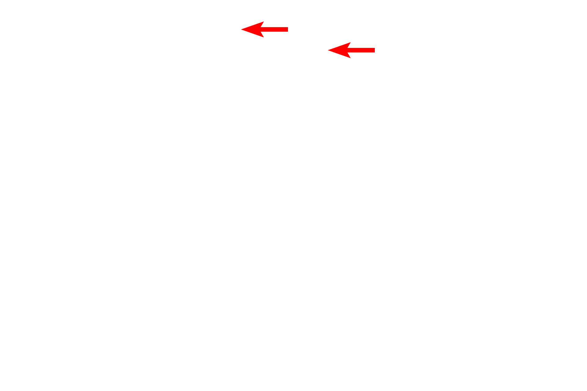 Desquamated cells <p>This electron micrograph shows the outermost layers of cells of the stratum corneum with two desquamated cells at its surface.  Each keratinized cell is less than one micron thick and is filled with an amorphous matrix containing aggregated keratin filaments.  Desmosomal junctions are mostly degraded in the upper regions of the stratum corneum.  15,000x</p>
