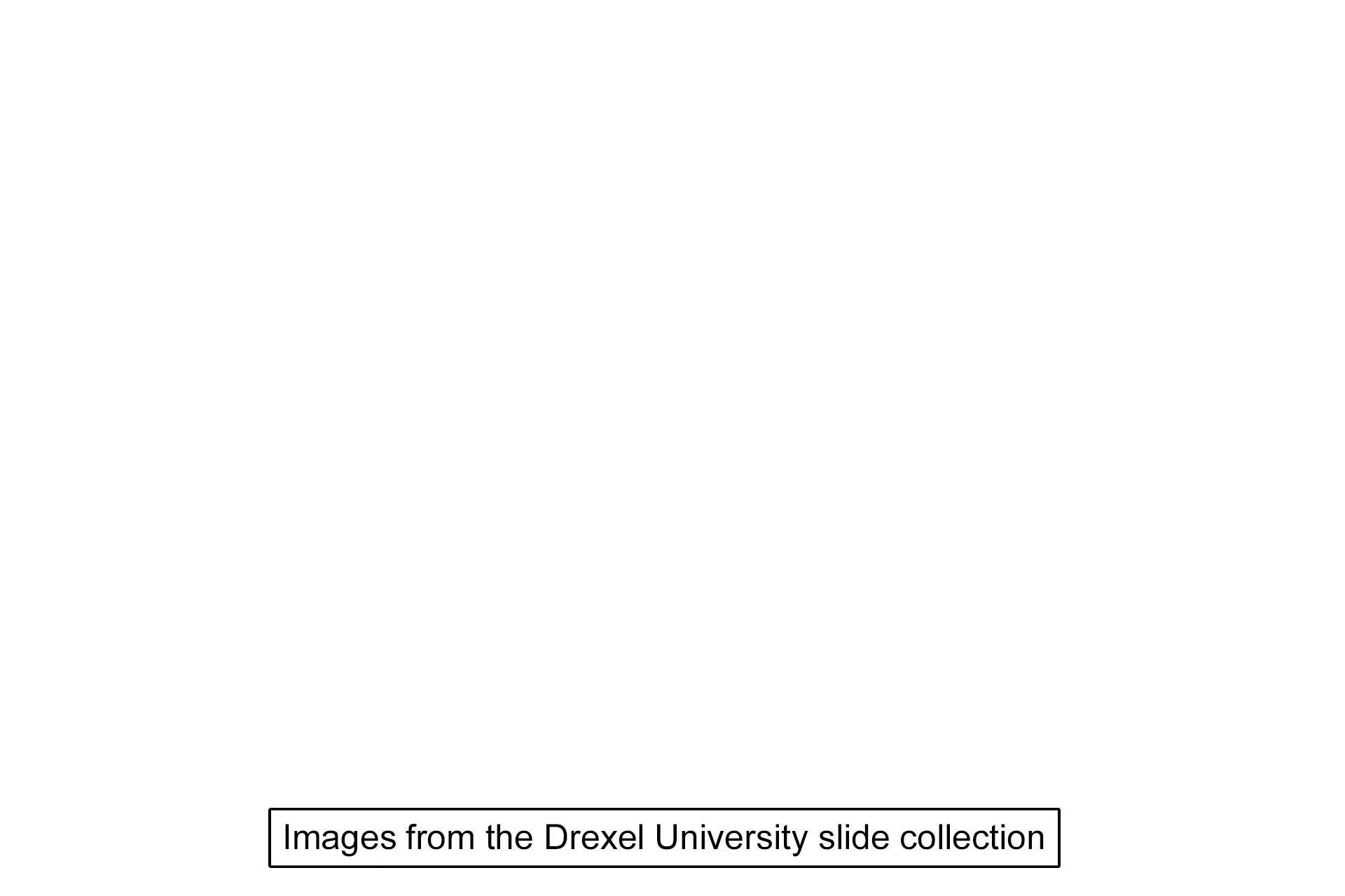 Image credit > <p>This image was taken of a slide in the Drexel University collection.</p>
