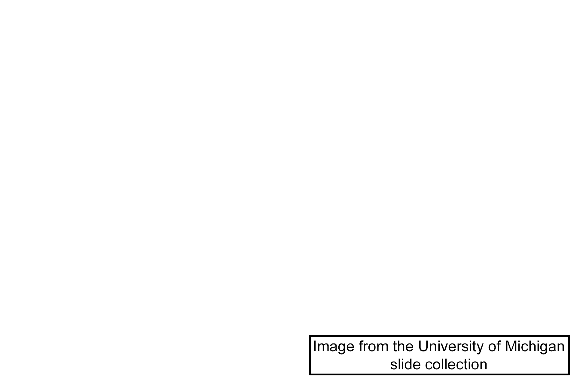 Image source > <p>The right image was taken of a slide from The University of Michigan collection.</p>
