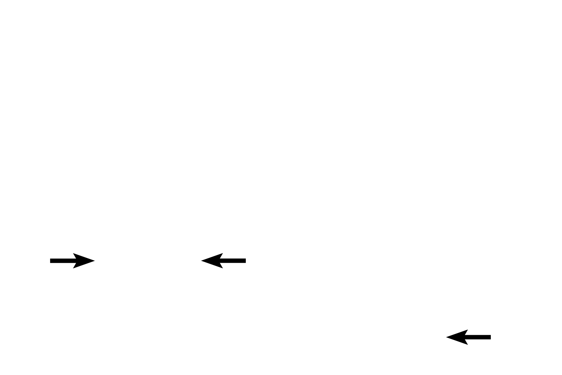  - Cricoid cartilage > <p>The cricoid cartilage, also composed of hyaline cartilage, encircles the larynx, providing the major posterior support.</p>
