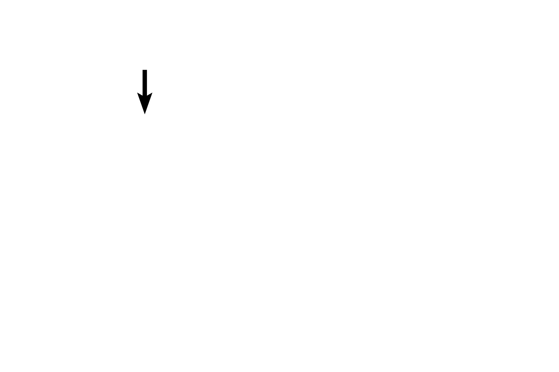 Vestibule > <p>The vestibule separates the two ventricular folds.</p>
