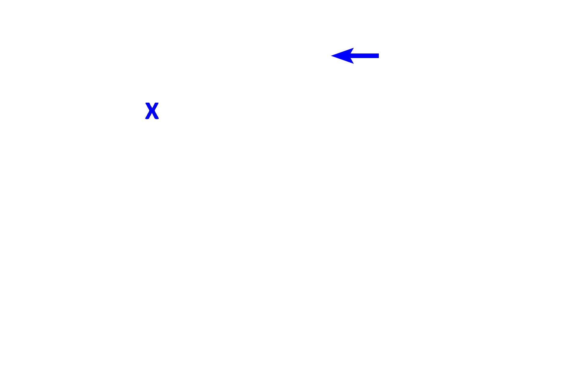 Vestibule > <p>The vestibule separates the two ventricular folds. </p>
