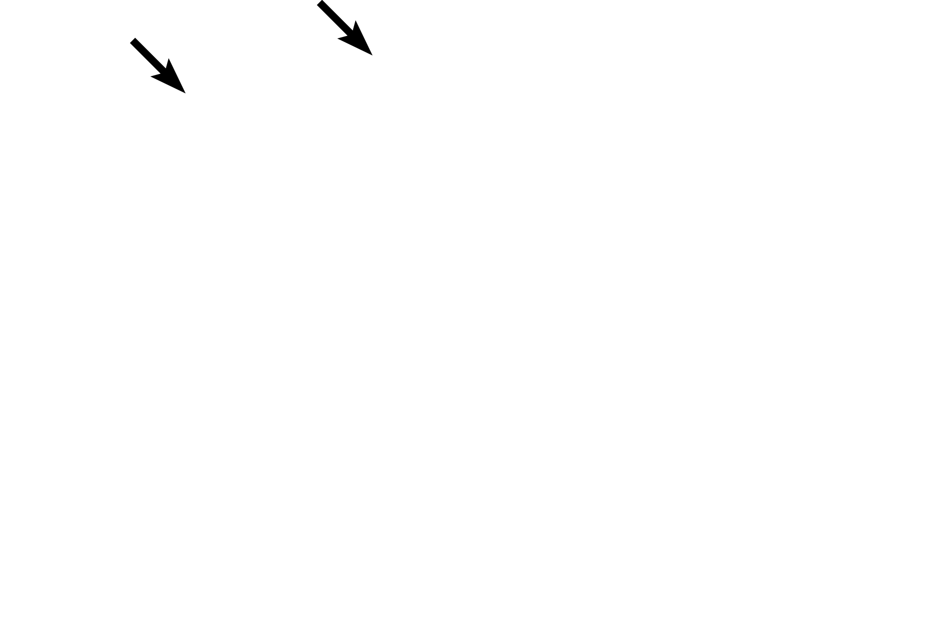  - Cilia <p>The epithelium lining most of the nasal cavities is a thin, respiratory epithelium:   pseudostratified columnar epithelium with cilia and goblet cells (which are not readily visible here, probably because this is fetal tissue and these cells are not functional yet). </p>
