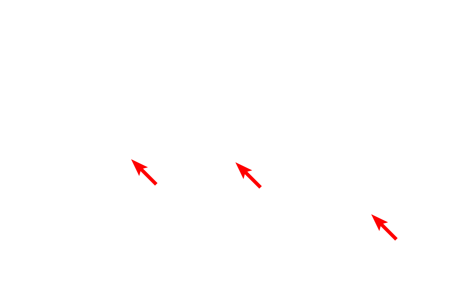  - Mixed gands <p>The lamina propria of the nasal cavity lacks a smooth muscle layer and an elastic lamina.  Numerous glands (mixed glands, when functional after birth) are present, as are numerous blood vessels to moderate air temperature.  Sensory, peripheral nerves also traverse this layer. </p>
