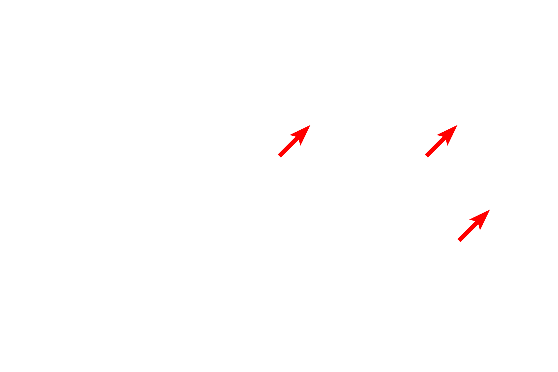  - Blood vessels <p>The lamina propria of the nasal cavity lacks a smooth muscle layer and an elastic lamina.  Numerous glands (mixed glands, when functional after birth) are present, as are numerous blood vessels to moderate air temperature.  Sensory, peripheral nerves also traverse this layer. </p>
