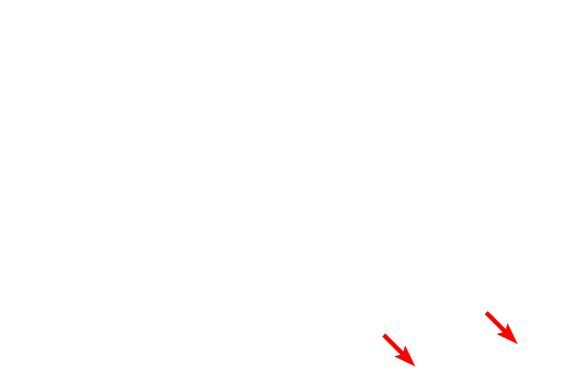 Cartilage > <p>All the extra-pulmonary structures of the respiratory system are supported by either bone or cartilage to maintain patency.  In the nasal cavity both cartilage and bone are present in different locations to keep this passageway open.</p>
