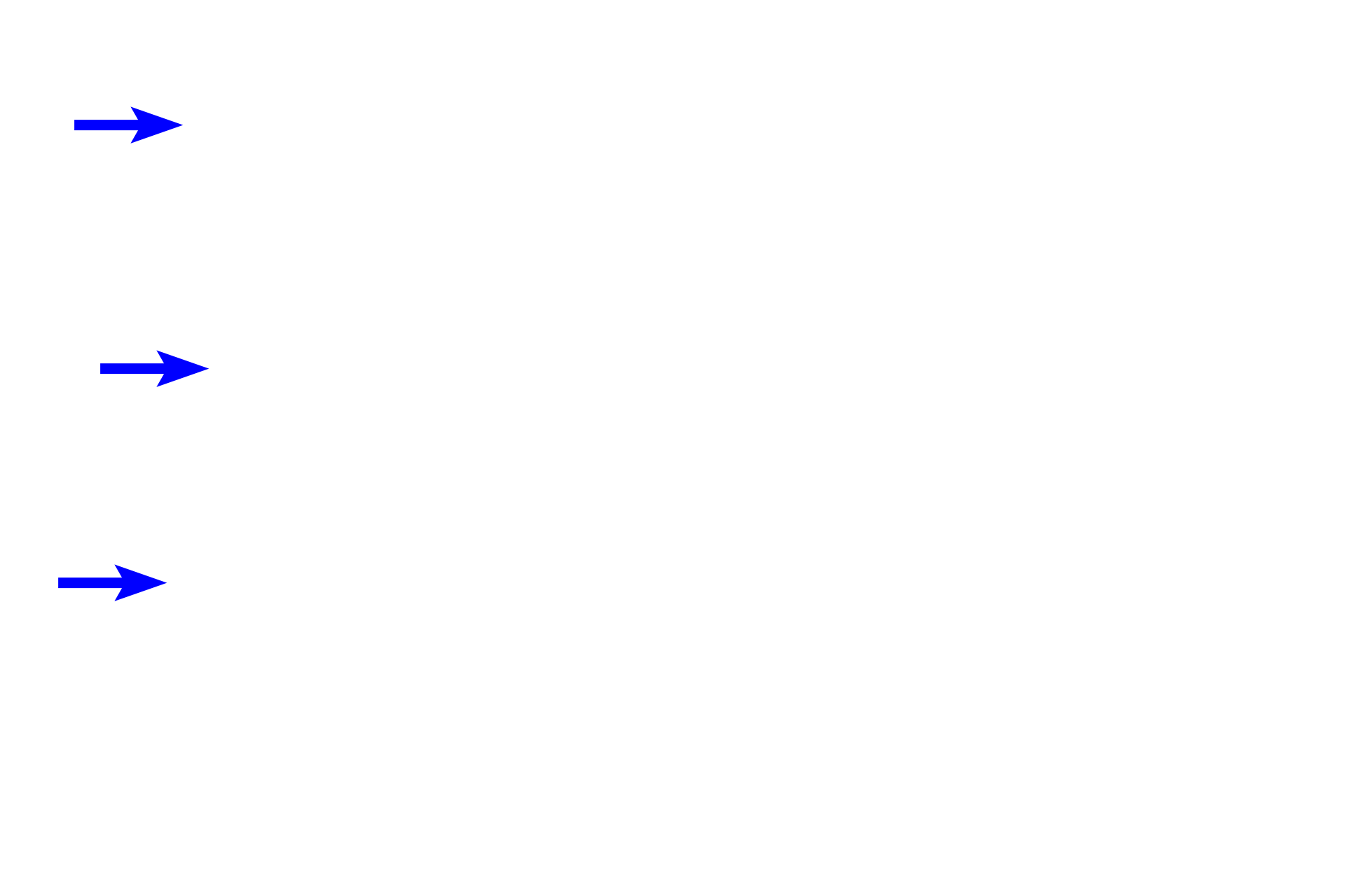 Respiratory epithelium > <p>Respiratory epithelium lines the non-olfactory region of the nasal fossae, represented here by the lateral surface of a superior concha.  This epithelium is pseudostratified columnar epithelium with cilia, goblet cells and neuronal cell bodies. The underlying lamina propria is rich in blood vessels to moderate air temperature.</p>
