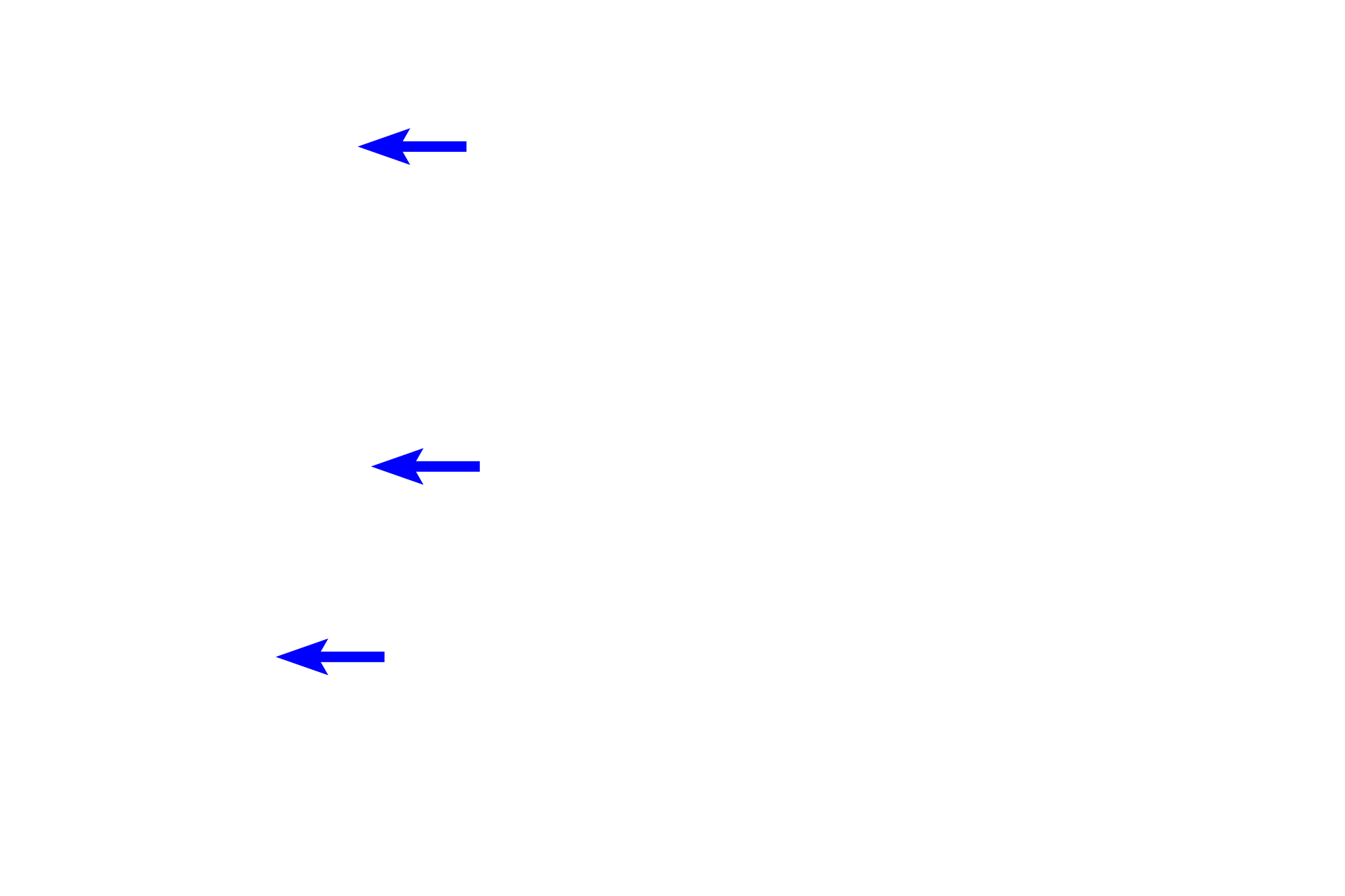 Ethmoid bone > <p>An extension of the ethmoid bone, the superior concha, provides internal support.</p>
