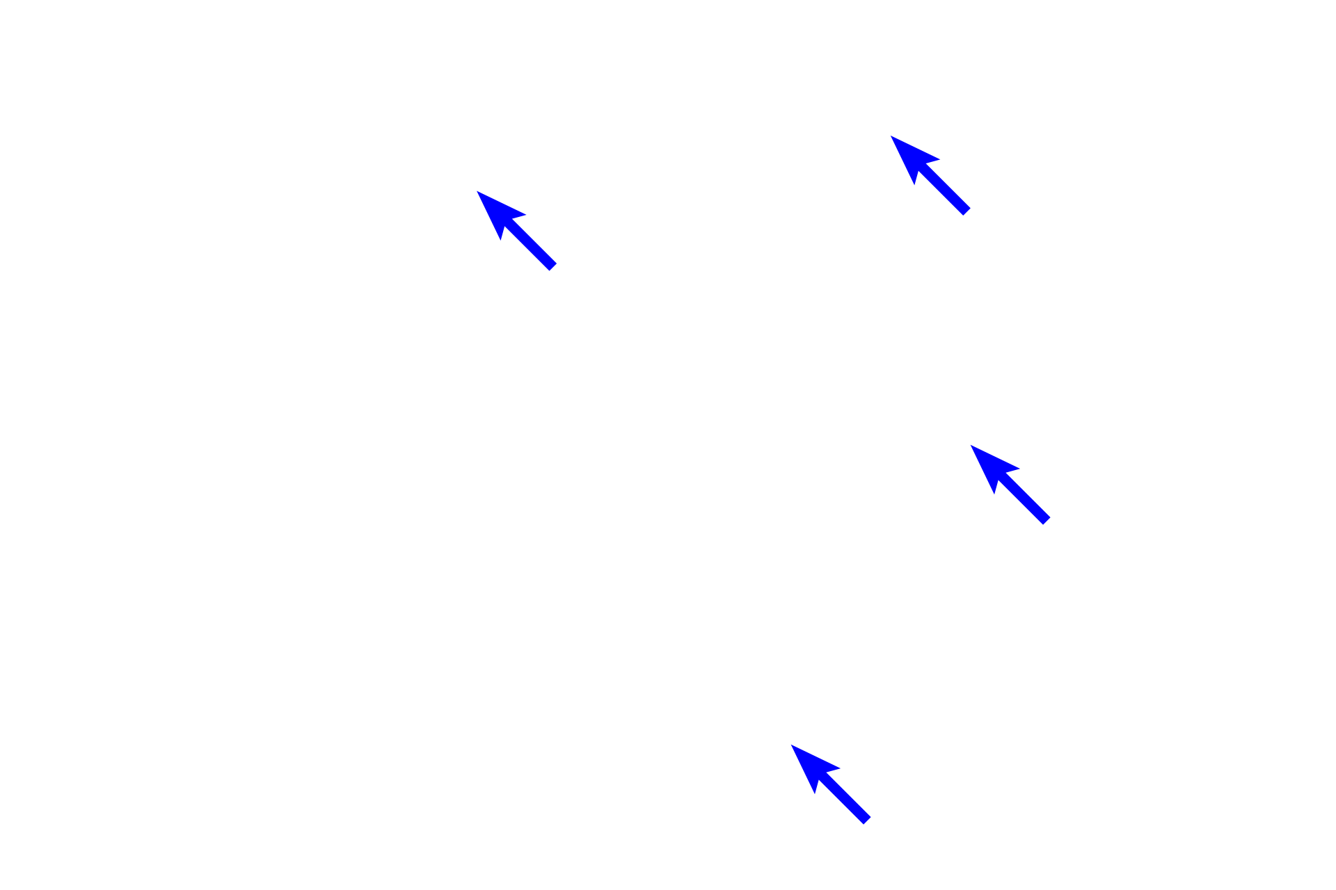  - Bowman's glands <p>Olfactory epithelium lines the medial surface of the superior concha. This pseudostratified columnar epithelium with cilia is markedly thicker than that of respiratory regions. The underlying lamina propria is also thicker, filled with serous secreting Bowman’s glands and cranial sensory nerves supplying both general and special sensations.  </p>
