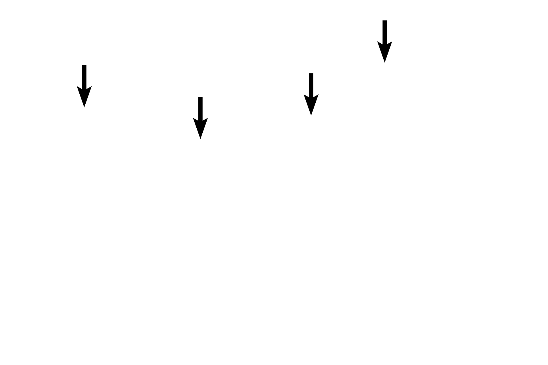  - Cilia <p>This particular section shows the junction of respiratory with olfactory epithelia, demonstrating the difference in their thicknesses. Numerous blood vessels are present to moderate air temperature. The superior concha of the ethmoid bone provides support. 400x</p>
