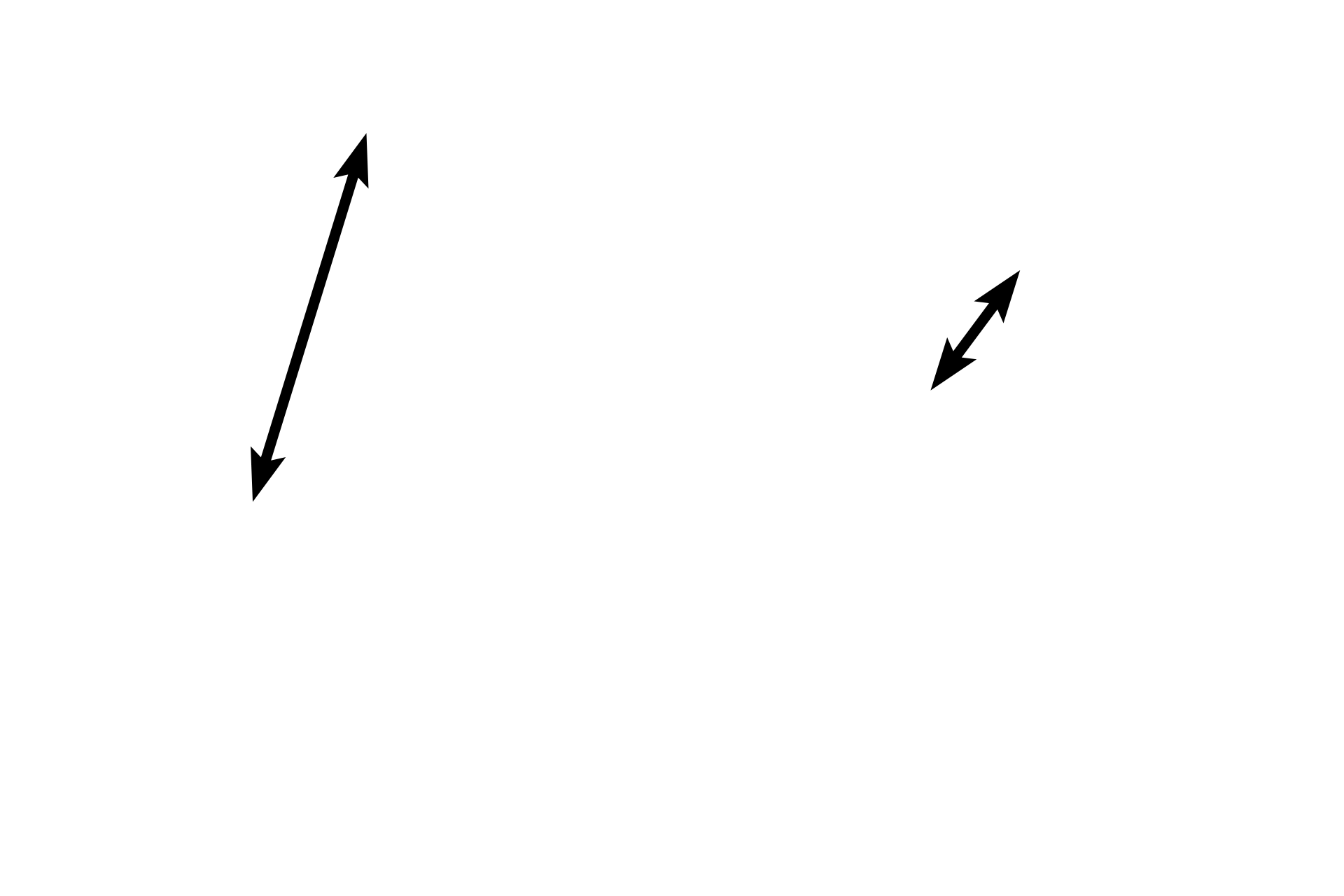 Pseudostratified  epithelium <p>In addition to the loss of cartilage and mixed glands in bronchioles, the height of the epithelium decreases as bronchioles get smaller in diameter. Although both of the bronchioles here are lined by pseudostratified columnar epithelium, the height of this epithelium is lower than that seen in the larger bronchioles of the previous images. 1000x, 400x </p>
