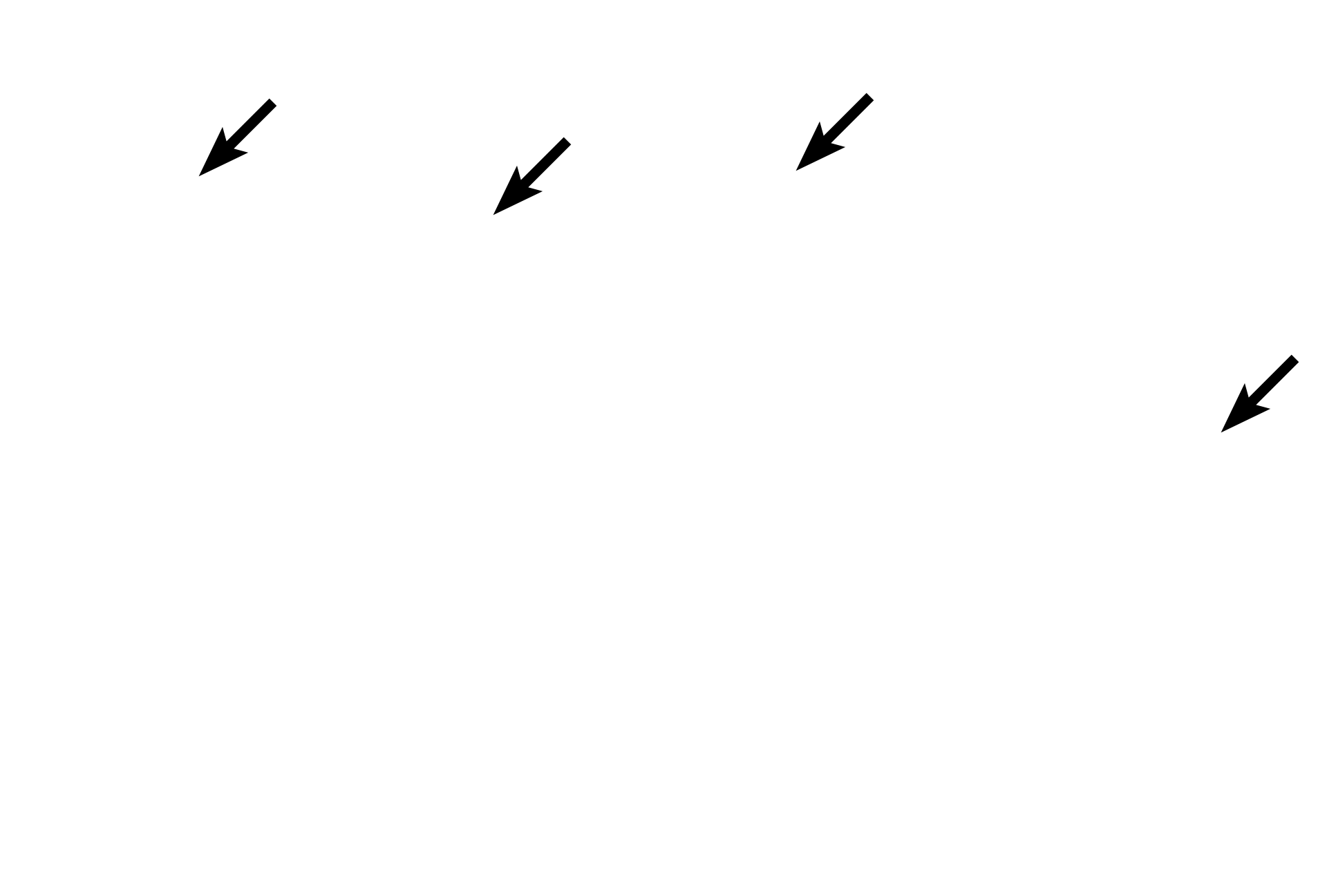  - Cilia <p>In addition to the loss of cartilage and mixed glands in bronchioles, the height of the epithelium decreases as bronchioles get smaller in diameter. Although both of the bronchioles here are lined by pseudostratified columnar epithelium, the height of this epithelium is lower than that seen in the larger bronchioles of the previous images. 1000x, 400x </p>
