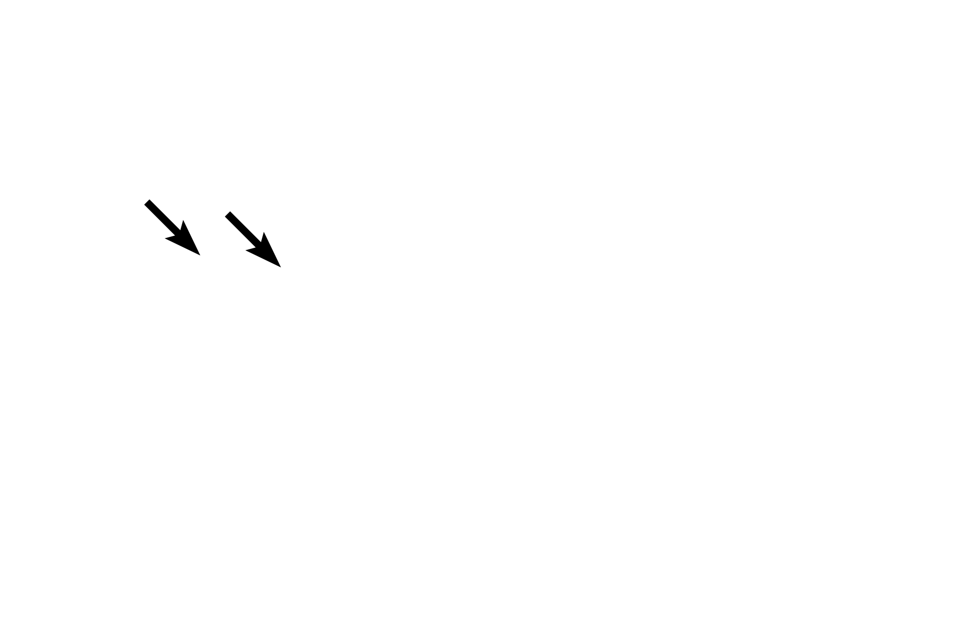  - Goblet cells  <p>In addition to the loss of cartilage and mixed glands in bronchioles, the height of the epithelium decreases as bronchioles get smaller in diameter. Although both of the bronchioles here are lined by pseudostratified columnar epithelium, the height of this epithelium is lower than that seen in the larger bronchioles of the previous images. 1000x, 400x </p>

