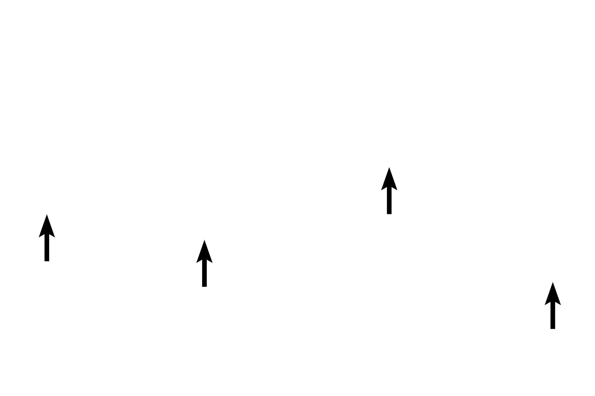  - Basement  membrane <p>In addition to the loss of cartilage and mixed glands in bronchioles, the height of the epithelium decreases as bronchioles get smaller in diameter. Although both of the bronchioles here are lined by pseudostratified columnar epithelium, the height of this epithelium is lower than that seen in the larger bronchioles of the previous images. 1000x, 400x </p>
