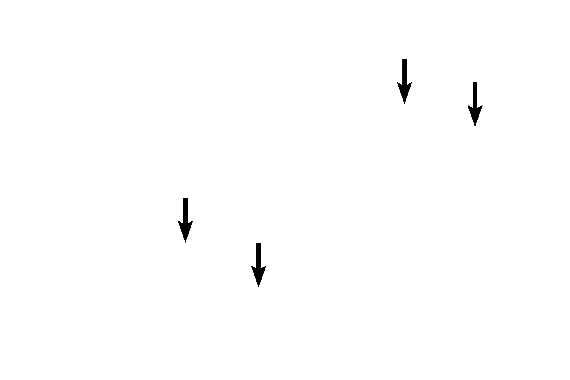 Simple columnar epithelium <p>As bronchioles continue to decrease in diameter, their pseudostratified epithelium decreases in thickness until it becomes simple columnar epithelium with cilia in the smallest, or terminal, bronchioles. Goblet cells are not present in terminal bronchioles, but another secretory cell type, the club cell, appears. 400x, 1000x</p>
