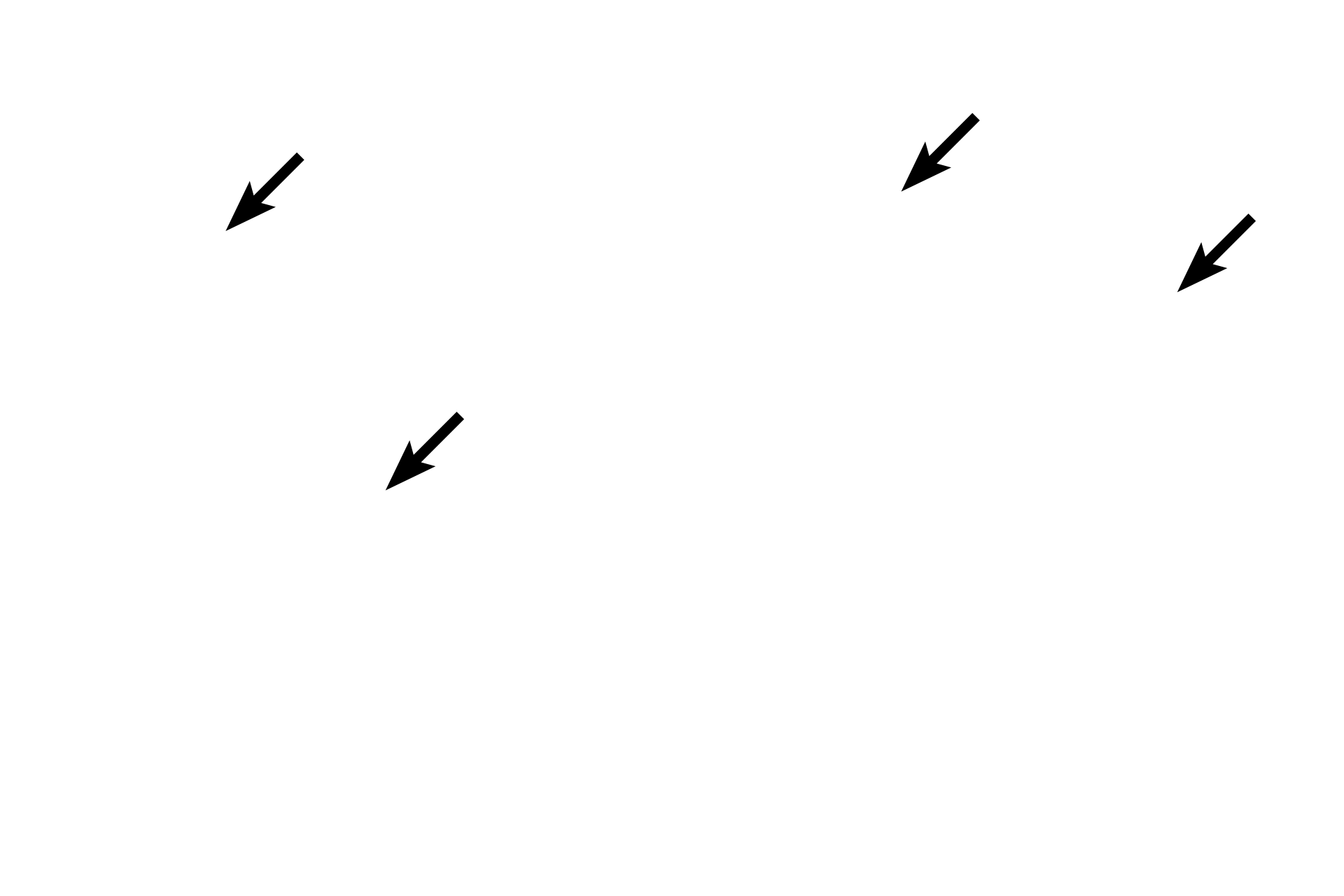  - Cilia <p>As bronchioles continue to decrease in diameter, their pseudostratified epithelium decreases in thickness until it becomes simple columnar epithelium with cilia in the smallest, or terminal, bronchioles. Goblet cells are not present in terminal bronchioles, but another secretory cell type, the club cell, appears. 400x, 1000x</p>
