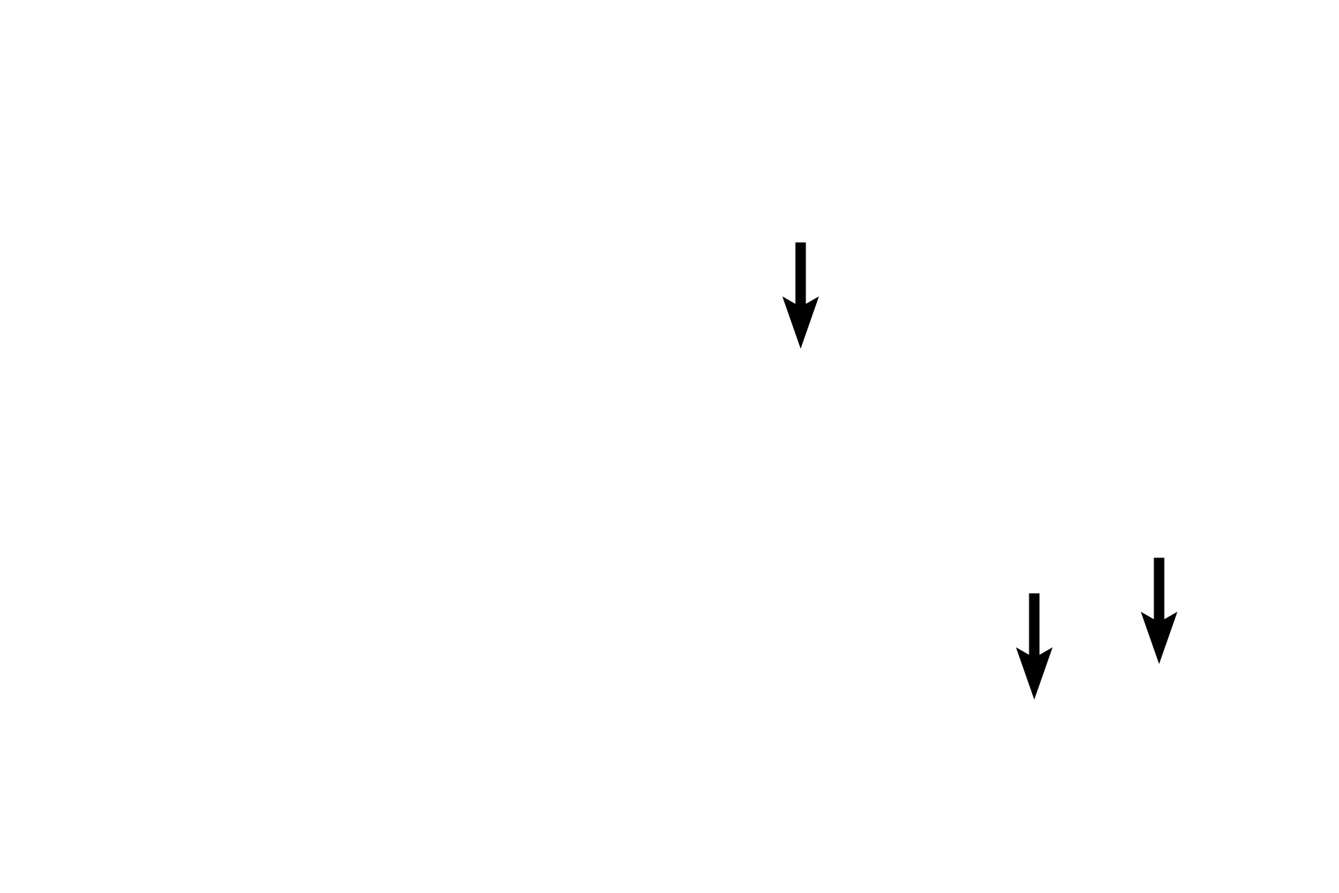 Cartilage plates <p>Smooth muscle is present in both passageways, but cartilage plates are present only in the secondary bronchus and not in the bronchiole.</p>
