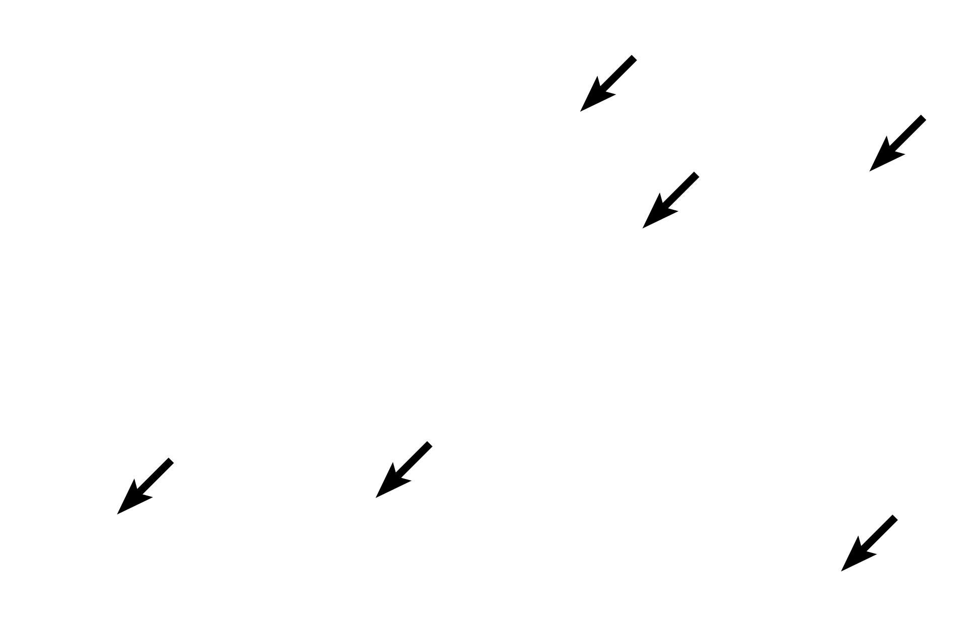 Alveoli > <p>Alveoli are visible in the field and therefore these passageways are intrapulmonary.  However, the alveolar lumens are not continuous with those of the larger passageways and thus neither the secondary bronchus nor bronchiole are capable of gas exchange.</p>

