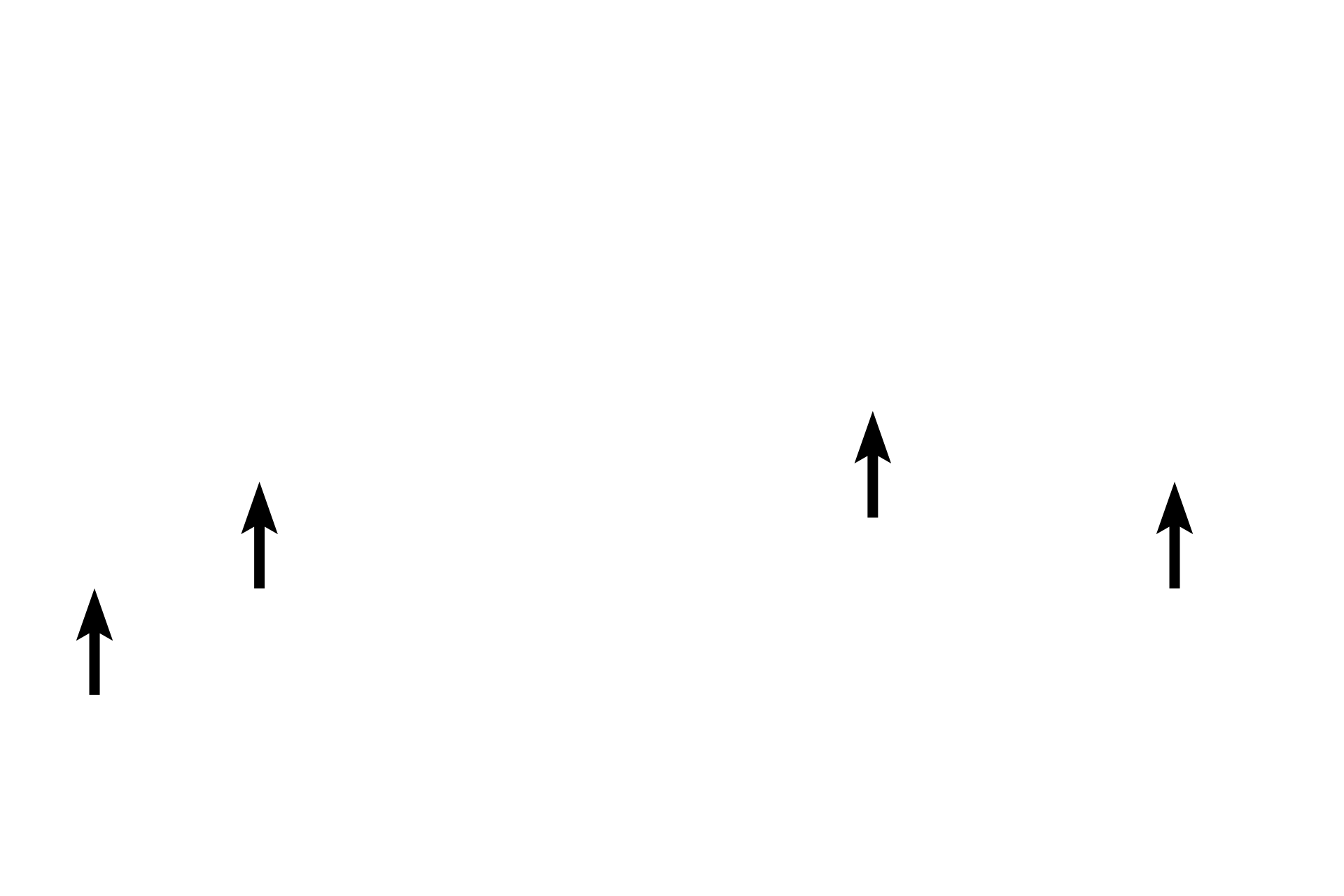  - Seromucous glands > <p>The connective tissue layer beneath the smooth muscle and/or elastic lamina (double-headed arrows) frequently contains mixed glands (G). Their secretions moisten the epithelium and, with cilia, form a mucociliary escalator to remove particulate matter and pollutants from inhaled air and transport them upward. These glands decrease in number and eventually disappear as the diameter of the passageways narrows. </p>
