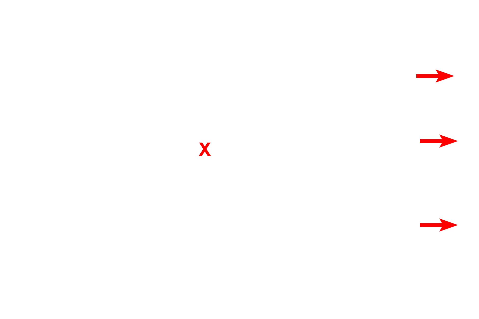 Pleural space <p>Each lung projects into an internal body cavity, the pleural cavity, and is covered by a serous membrane (serosa), called visceral pleura. A reflection of visceral pleura, the parietal pleura, lines the inside of the thoracic wall. Pleura is composed of a simple squamous epithelium (mesothelium) overlying a layer of connective tissue that contains blood vessels and elastic fibers. 200x</p>
