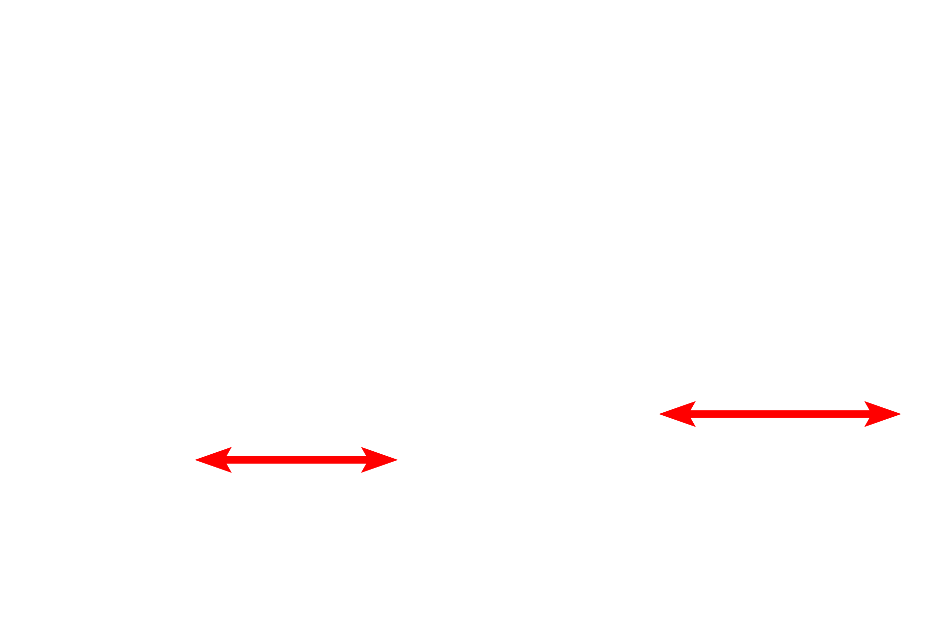 Visceral pleura <p>Each lung projects into an internal body cavity, the pleural cavity, and is covered by a serous membrane (serosa), called visceral pleura. A reflection of visceral pleura, the parietal pleura, lines the inside of the thoracic wall. Pleura is composed of a simple squamous epithelium (mesothelium) overlying a layer of connective tissue that contains blood vessels and elastic fibers. 200x</p>

