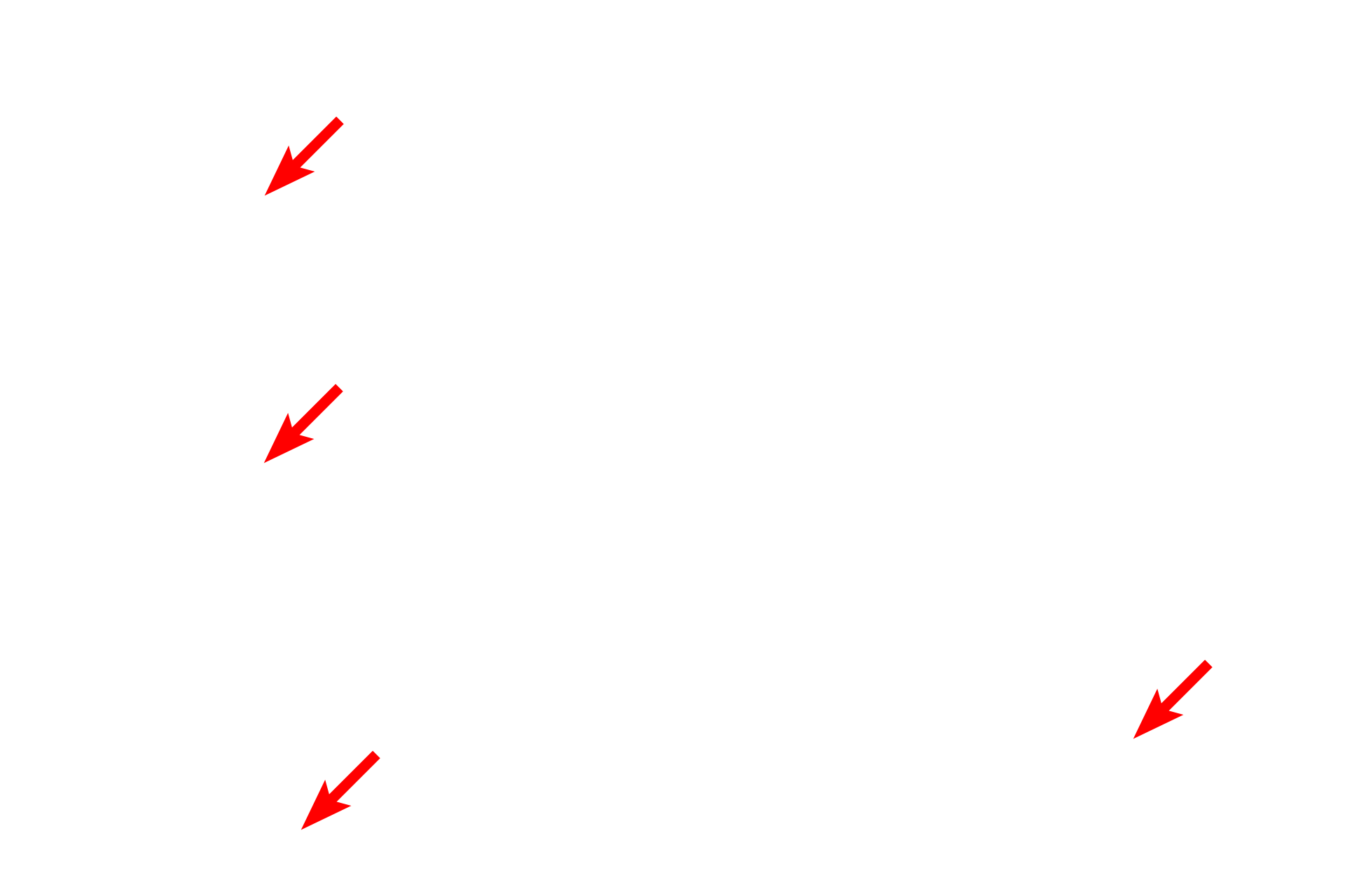 Macrophages <p>Each lung projects into an internal body cavity, the pleural cavity, and is covered by a serous membrane (serosa), called visceral pleura. A reflection of visceral pleura, the parietal pleura, lines the inside of the thoracic wall. Pleura is composed of a simple squamous epithelium (mesothelium) overlying a layer of connective tissue that contains blood vessels and elastic fibers. 200x</p>
