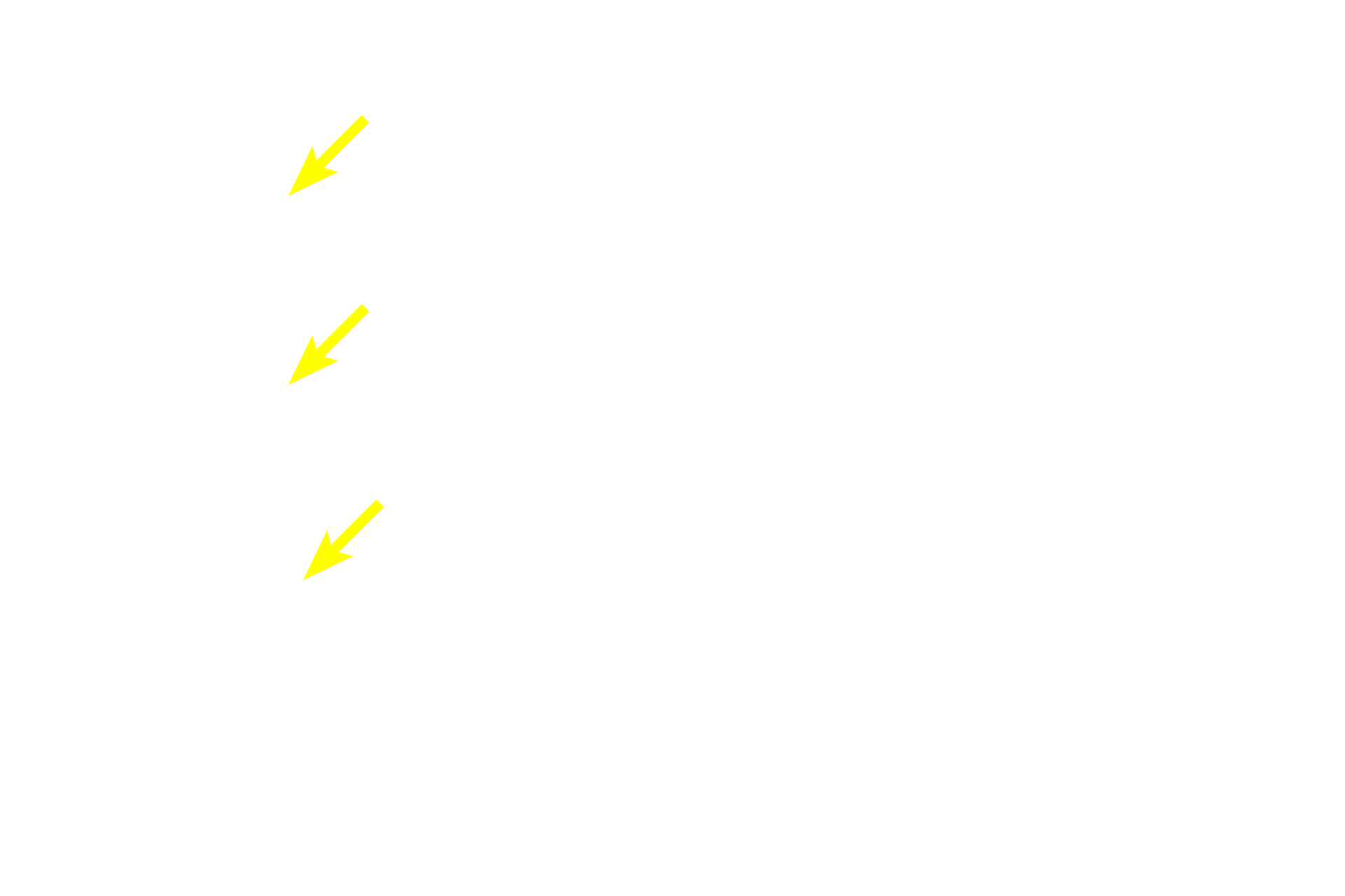 - Dermal papillae <p>The vermillion zone forms the red portion of the lip and like the skin on the surface of the lip, the epithelium here is keratinized and a stratum granulosum is present.   Imparting the red color to this region are the numerous, dermal papillae that allow close approximation of blood vessels to the surface.  </p>
