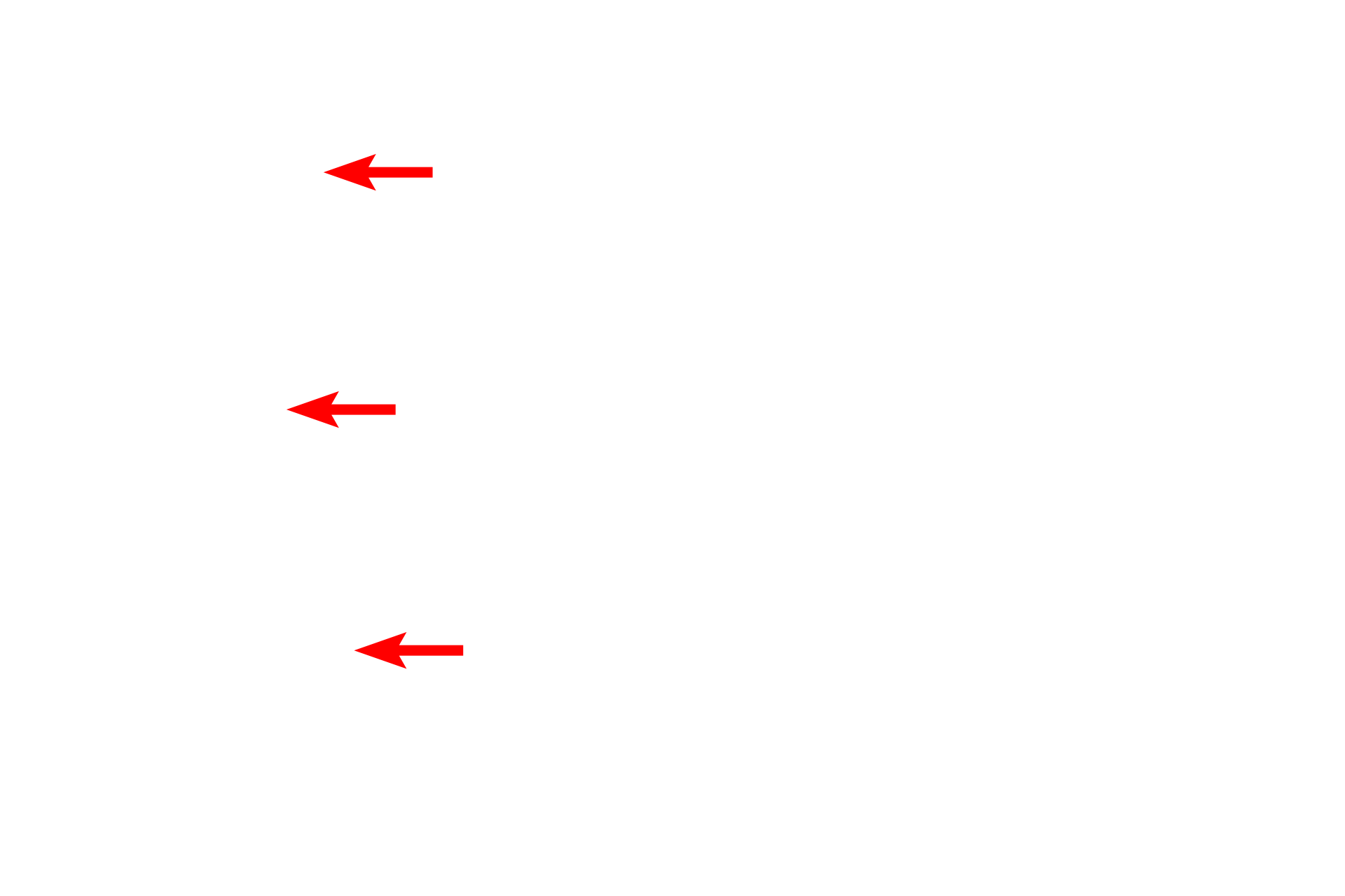  - Blood vessels <p>The vermillion zone forms the red portion of the lip and like the skin on the surface of the lip, the epithelium here is keratinized and a stratum granulosum is present.   Imparting the red color to this region are the numerous, dermal papillae that allow close approximation of blood vessels to the surface.  </p>
