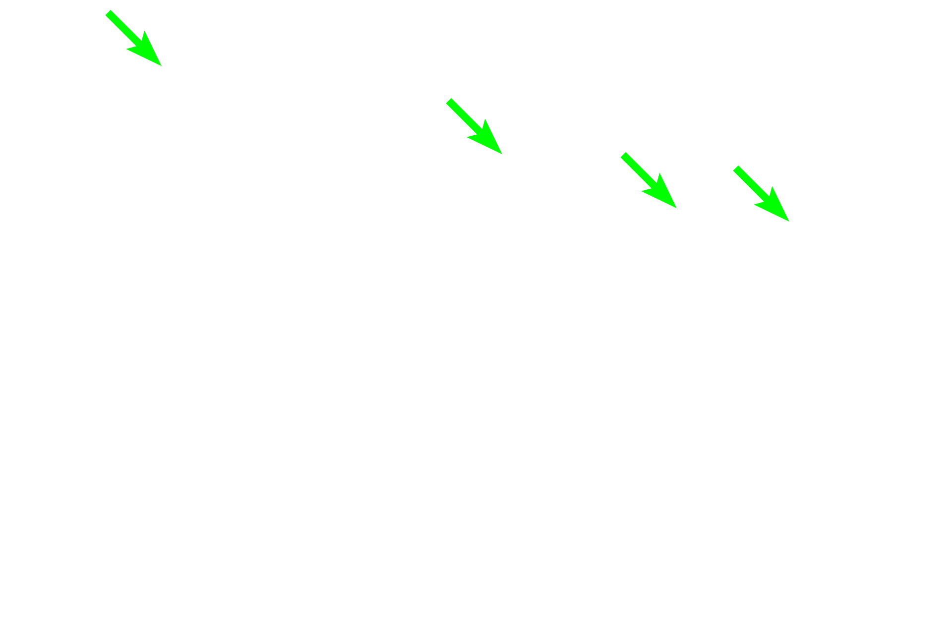  - Conical tips of papillae <p>The dorsal and lateral surfaces of the tongue are covered by specialized mucosa forming papillae:  filiform, fungiform, circumvallate, and foliate.  The tapering filiform papillae seen here are the most numerous type, covering most of the anterior two thirds of the tongue. Each papilla is about two to three millimeters long and is composed of a conical tip of keratinized, stratified squamous epithelium and an underlying core of connective tissue.  100x</p>
