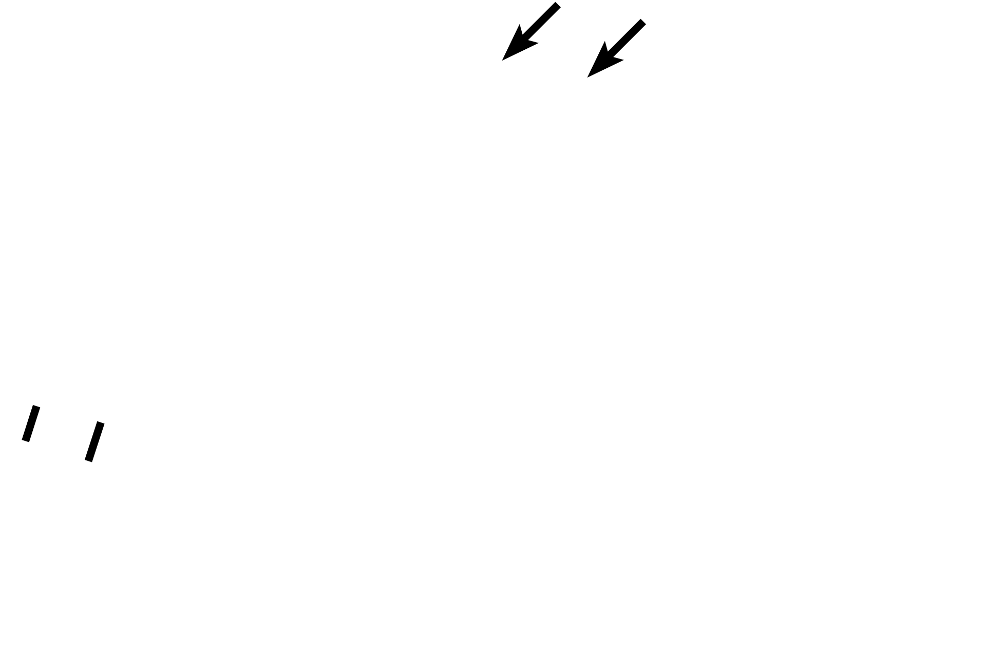 Nail plate <p>The fingernail (nail plate) corresponds to stratum corneum and rests on a nail bed of strata basale and spinosum.  The nail root lies in an epidermal fold, whose stratum corneum forms the eponychium (cuticle).  Beneath the root is the nail matrix, the germinative portion of the nail.  The hyponychium, a thickened epidermis, secures the nail at the fingertip.  Upper  4x; Lower  20x</p>
