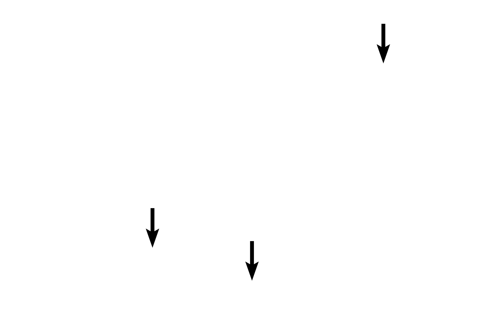 Nail root <p>The fingernail (nail plate) corresponds to stratum corneum and rests on a nail bed of strata basale and spinosum.  The nail root lies in an epidermal fold, whose stratum corneum forms the eponychium (cuticle).  Beneath the root is the nail matrix, the germinative portion of the nail.  The hyponychium, a thickened epidermis, secures the nail at the fingertip.  Upper  4x; Lower  20x</p>

