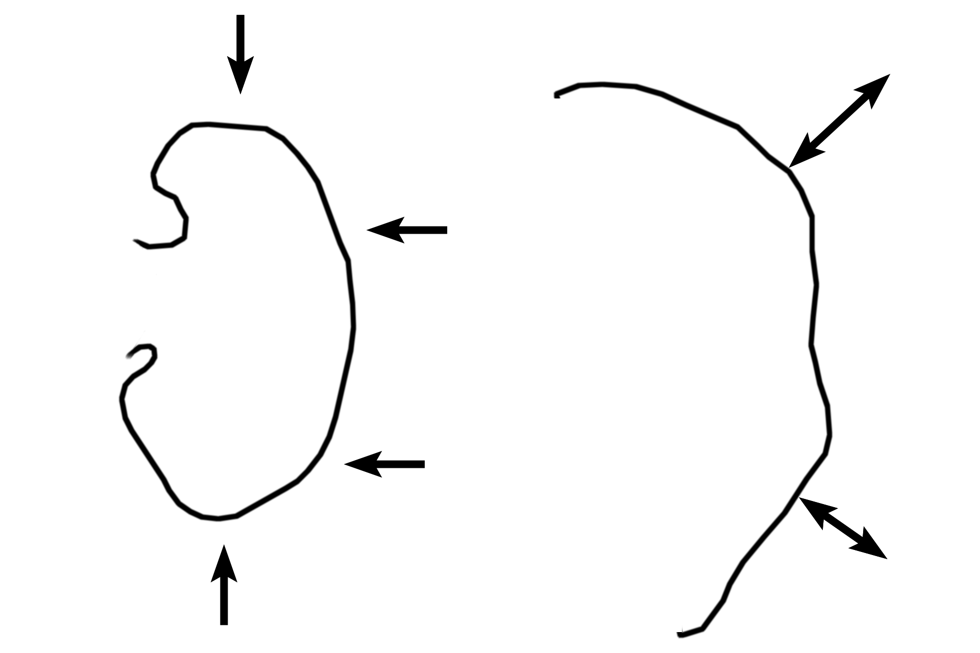 Cortex > <p>The cortex forms the outer rim of the kidney.  Although not readily visible at this magnification, the cortex can be subdivided into alternating, radially oriented bands called the convoluted portions and the medullary rays.</p>
