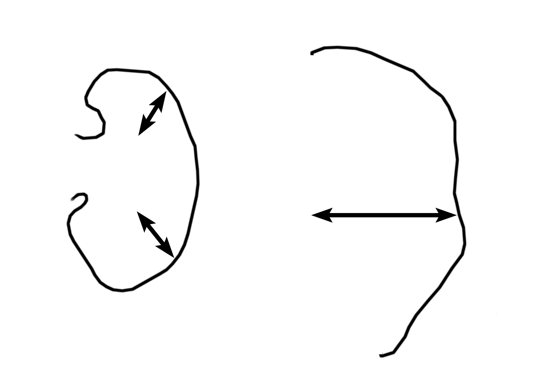 Medulla > <p>The medulla forms the inner portion of the kidney.  It is composed of renal pyramids, whose bases abut the cortex, and renal columns, i.e., cortical tissue interposed between the pyramids.</p>
