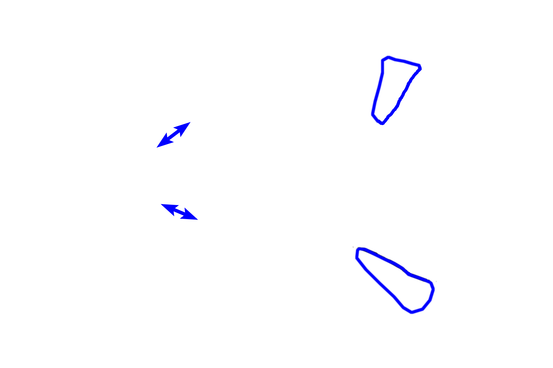  - Renal columns <p>The medulla forms the inner portion of the kidney.  It is composed of renal pyramids, whose bases abut the cortex, and renal columns, i.e., cortical tissue interposed between the pyramids.</p>
