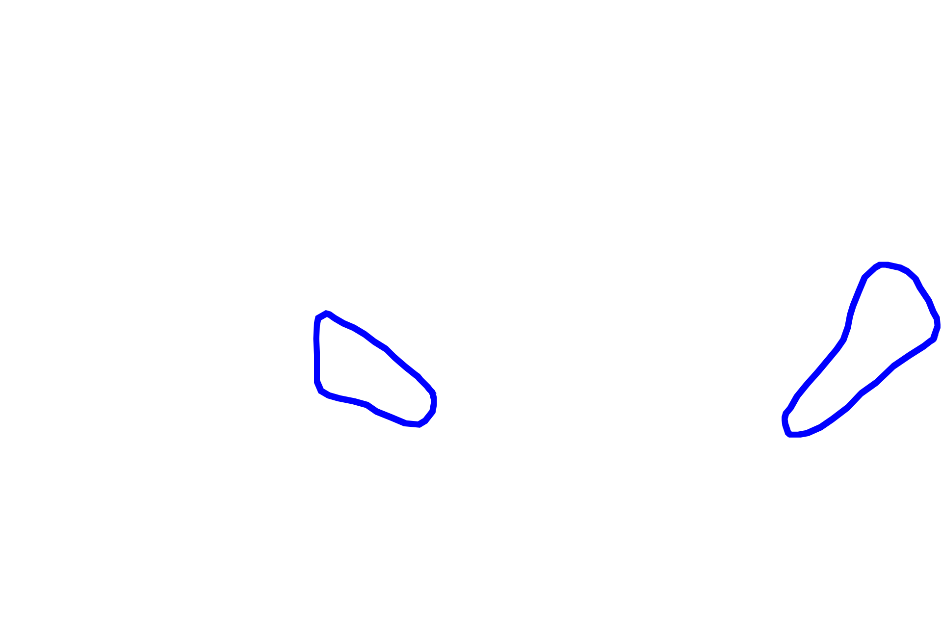  - Renal columns > <p>Renal columns are cortical tissue that is interposed between the pyramids.</p>
