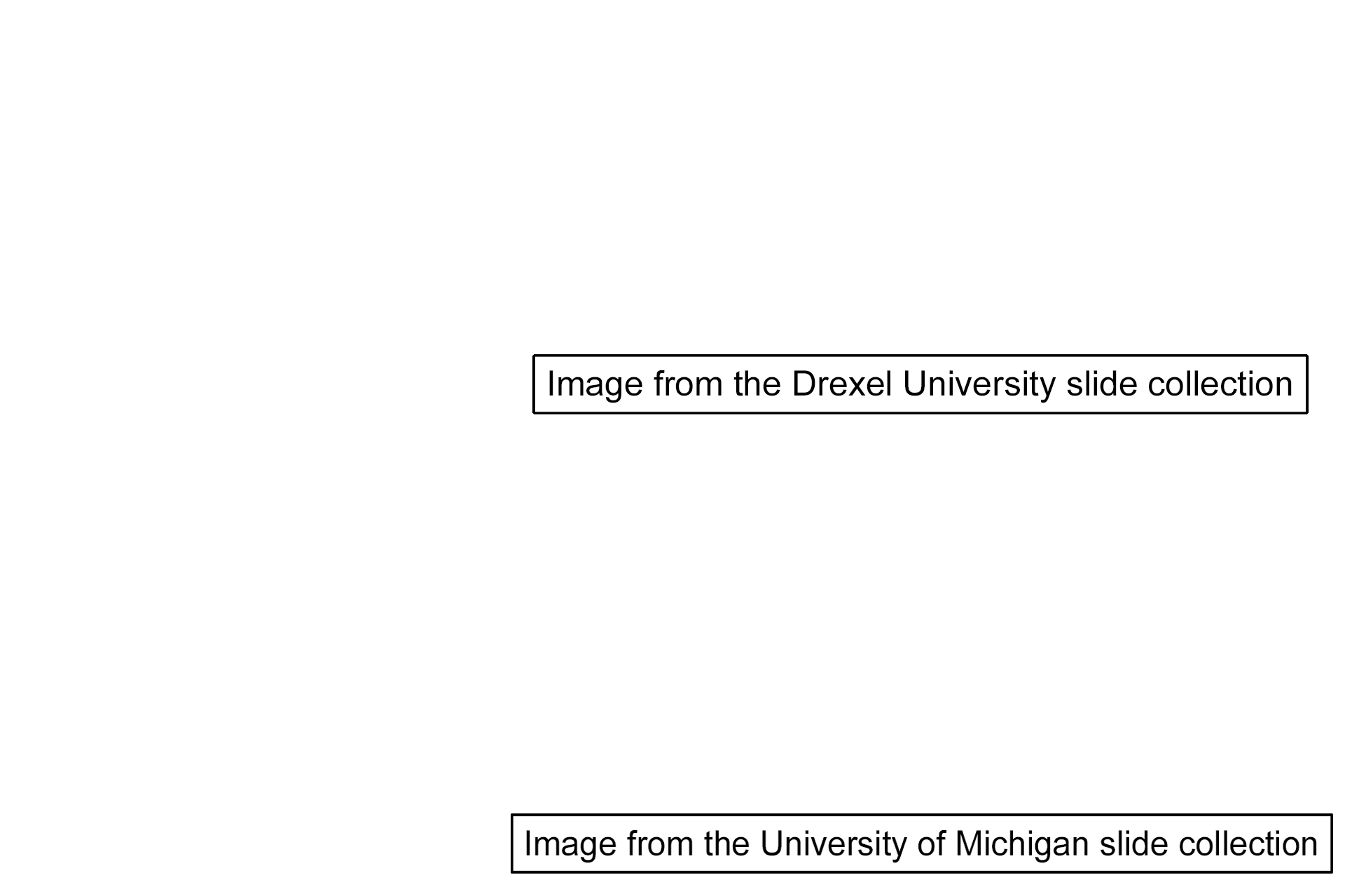 Image credits >  <p>Images were taken from slides in the Drexel University and the University of Iowa slide collections.</p>
