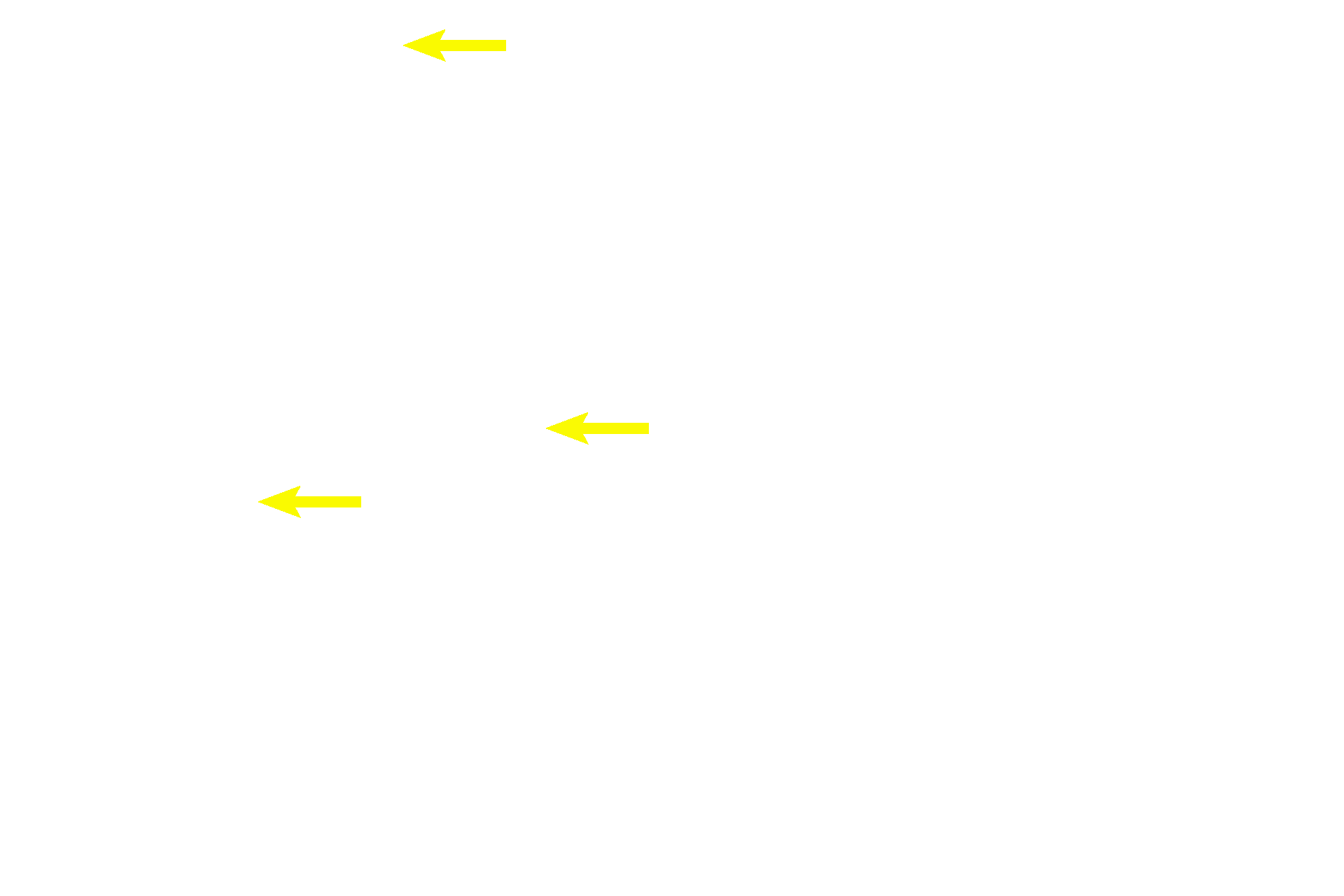  - Chondrocytes > <p>When chondroblasts have completely surrounded themselves by matrix they become chondrocytes and are located in potential spaces called lacunae. Chondrocytes continue to secrete matrix which provides growth of the cartilage from within. This type of growth is called interstitial growth and is analogous to bread dough rising.  Despite the fact that the matrix is firm and rubbery, is it sufficiently flexible to allow for expansion of the cartilage mass from within.</p>
