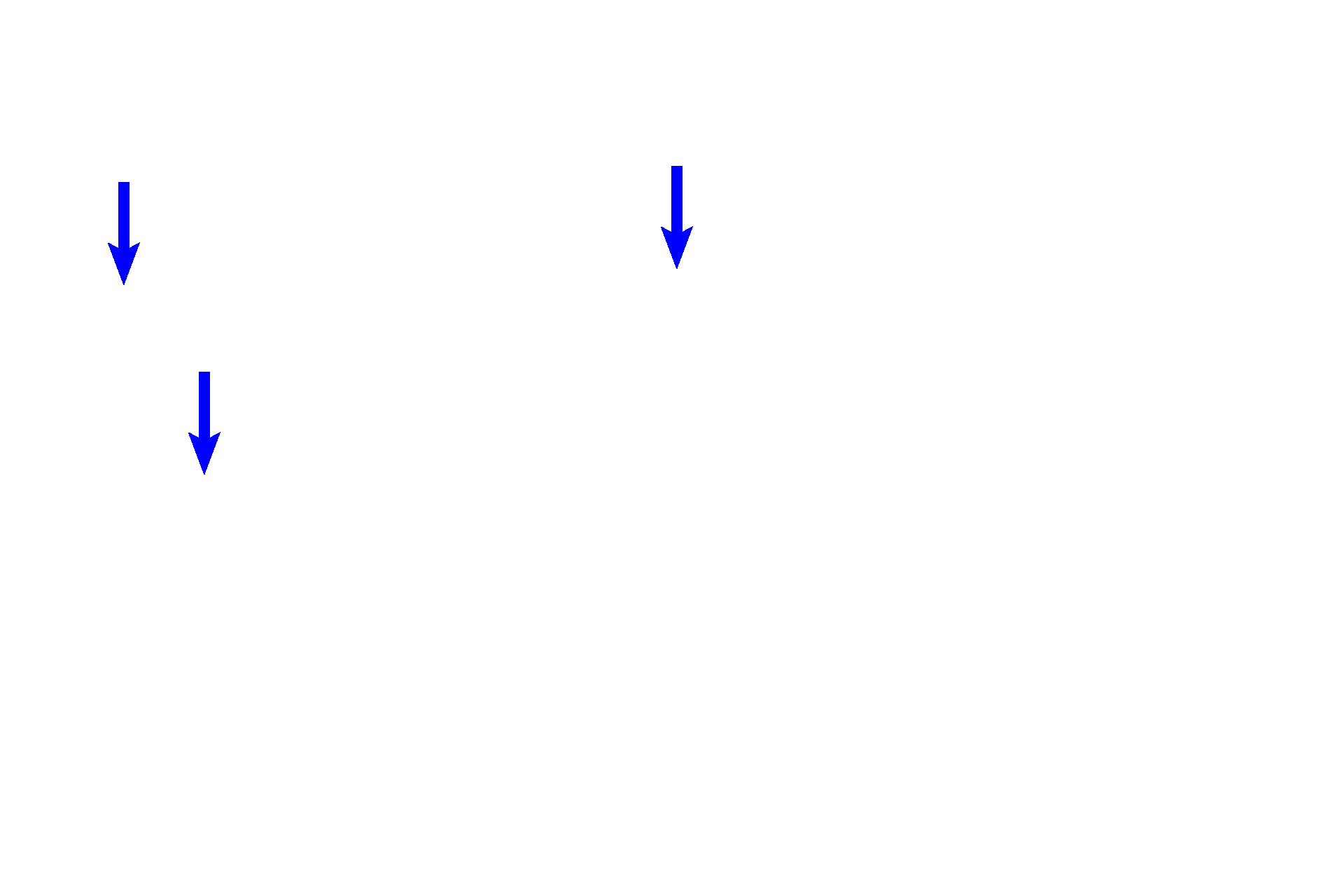 - Lipid droplets > <p>Clear spheres within these cells are lipid droplets.</p>

