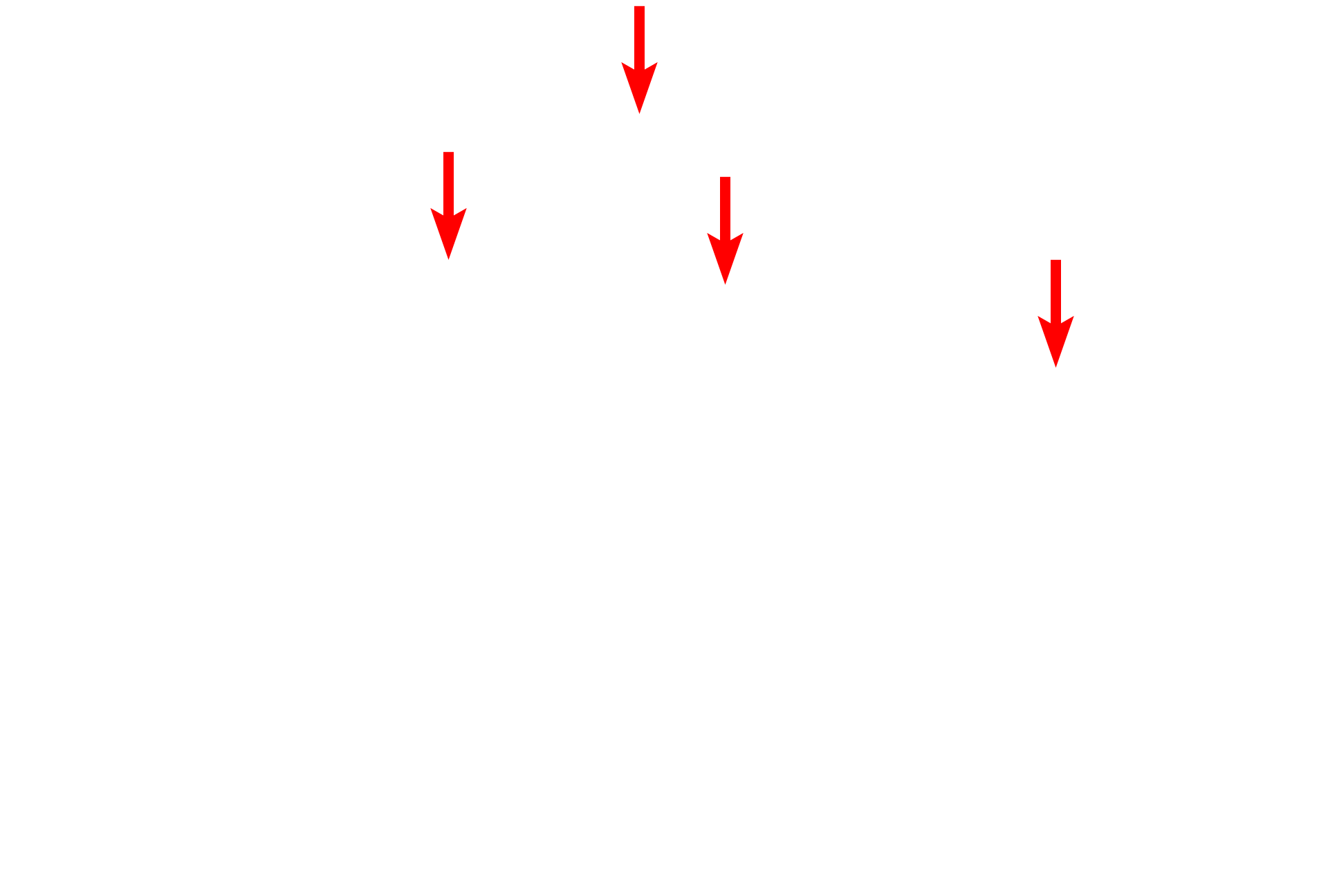 Hypertrophy > <p>Degenerating cartilage cells enlarge (hypertrophy), mature, and secrete alkaline phosphatase, which facilitates calcification of the matrix. A calcified matrix prohibits diffusion of nutrients, so chondrocytes die, leaving empty lacunae surrounded by a calcified cartilage matrix. These regressive stages occur in the aging process as well as in the epiphyseal plates of growing long bones.</p>
